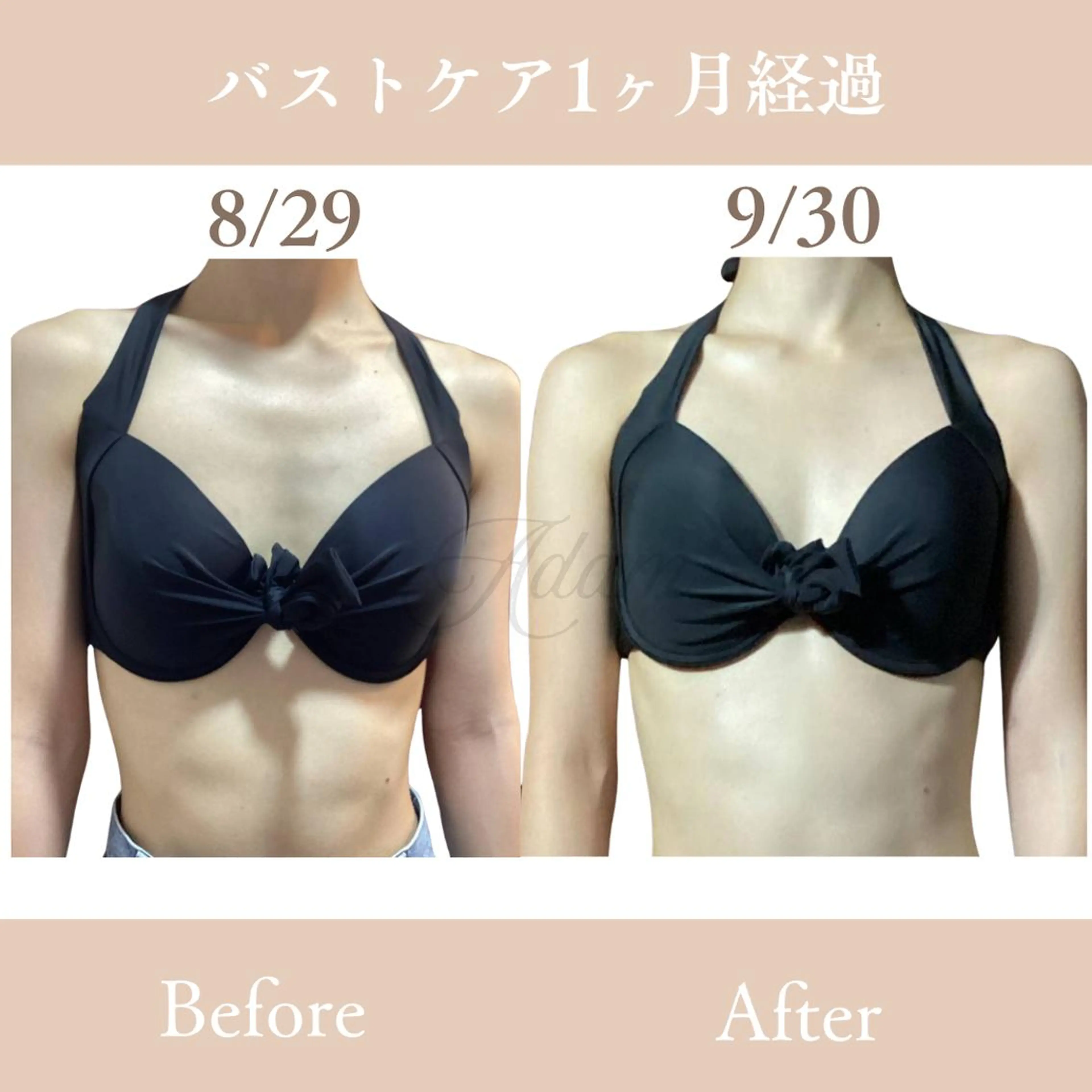 【バスト】人気No.3✨姿勢から改善♡ふわふわ美乳/バストケア/痩身の写真