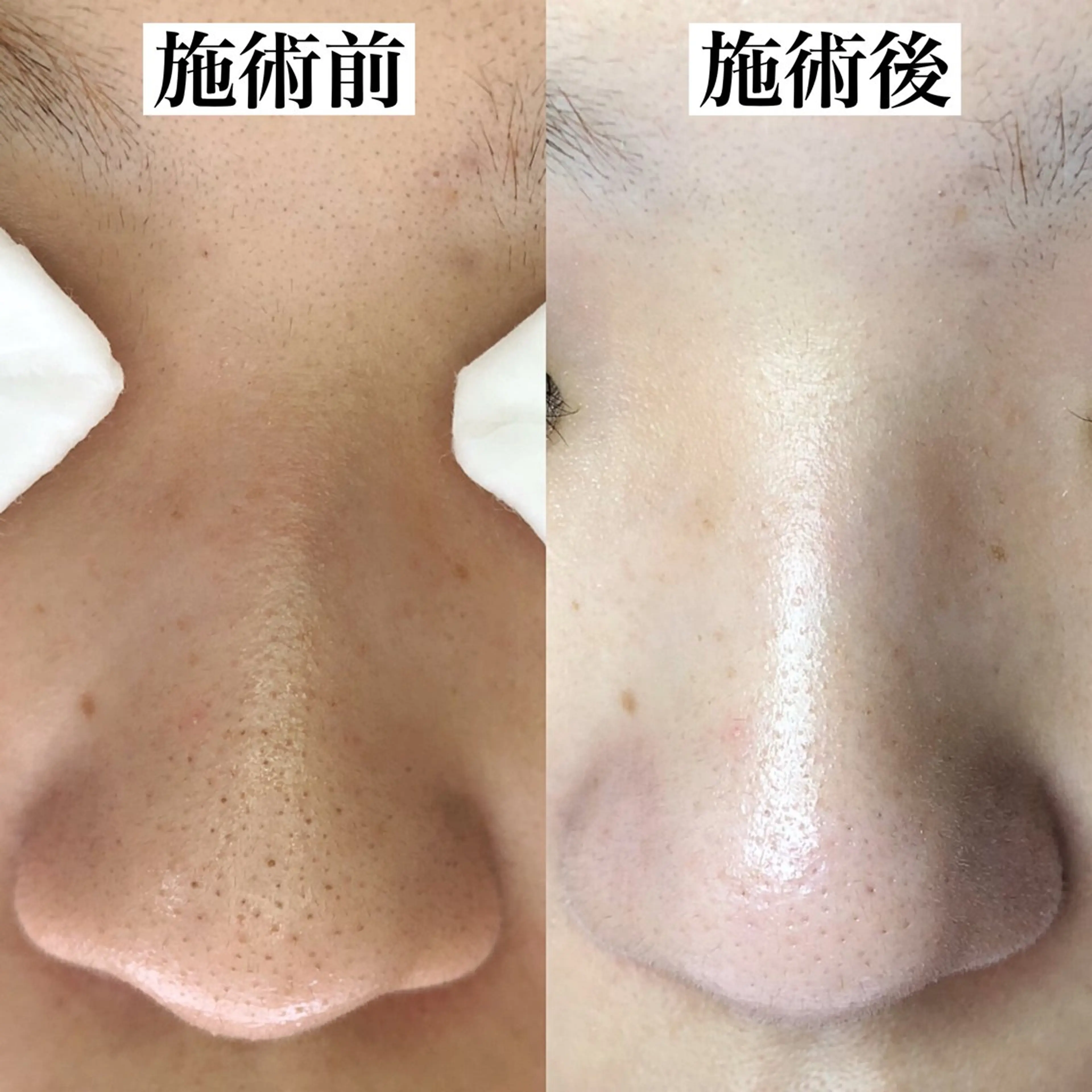 エステ Soare(ソアレ)所属・【結果重視】 毛穴専門店のエステ・リラクイメージ