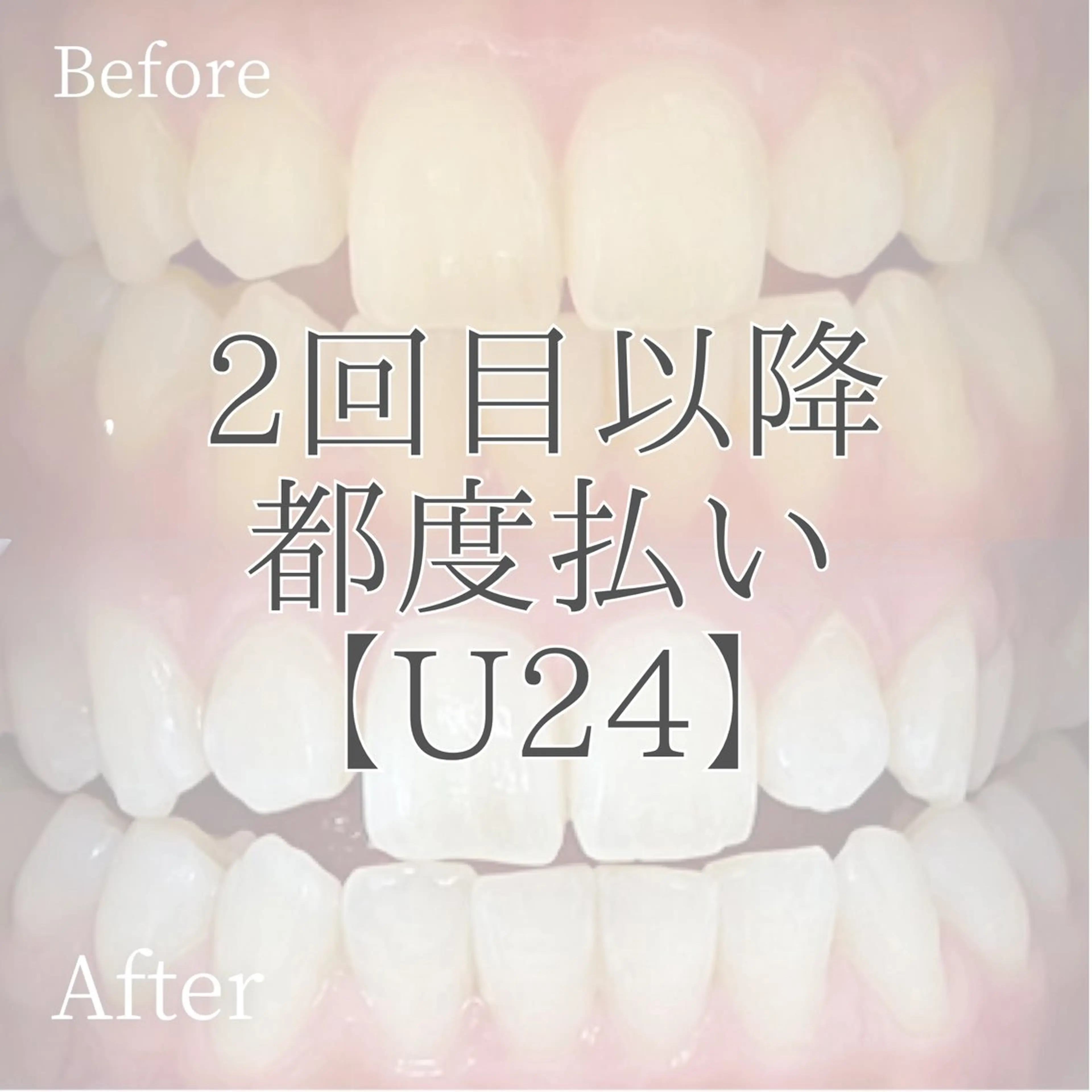 メンズ キッズ ホワイトニング ショップ多摩店のその他イメージ