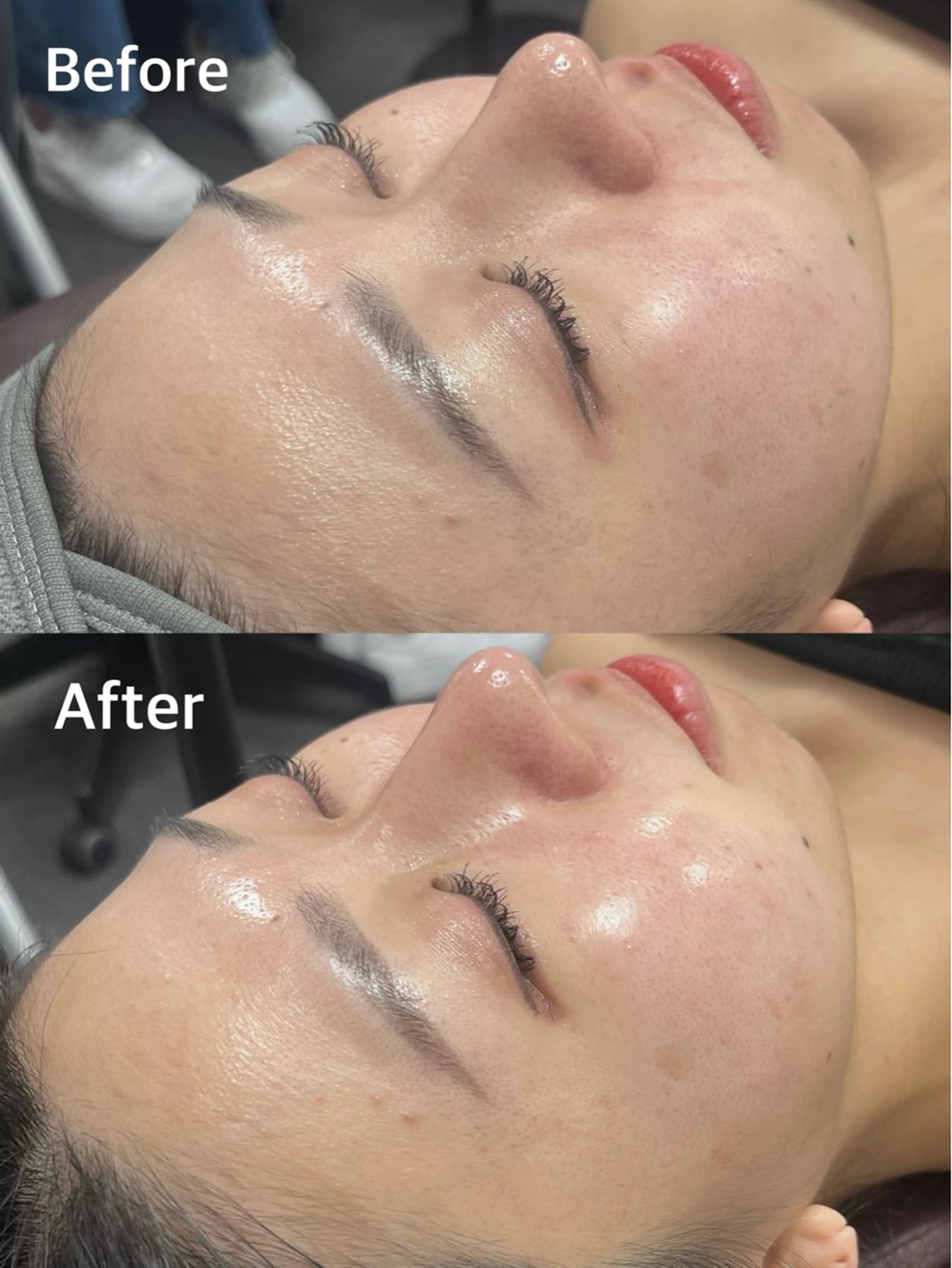 エステ クラスペディア脱毛 ・フェイシャル専門店のエステ・リラクイメージ