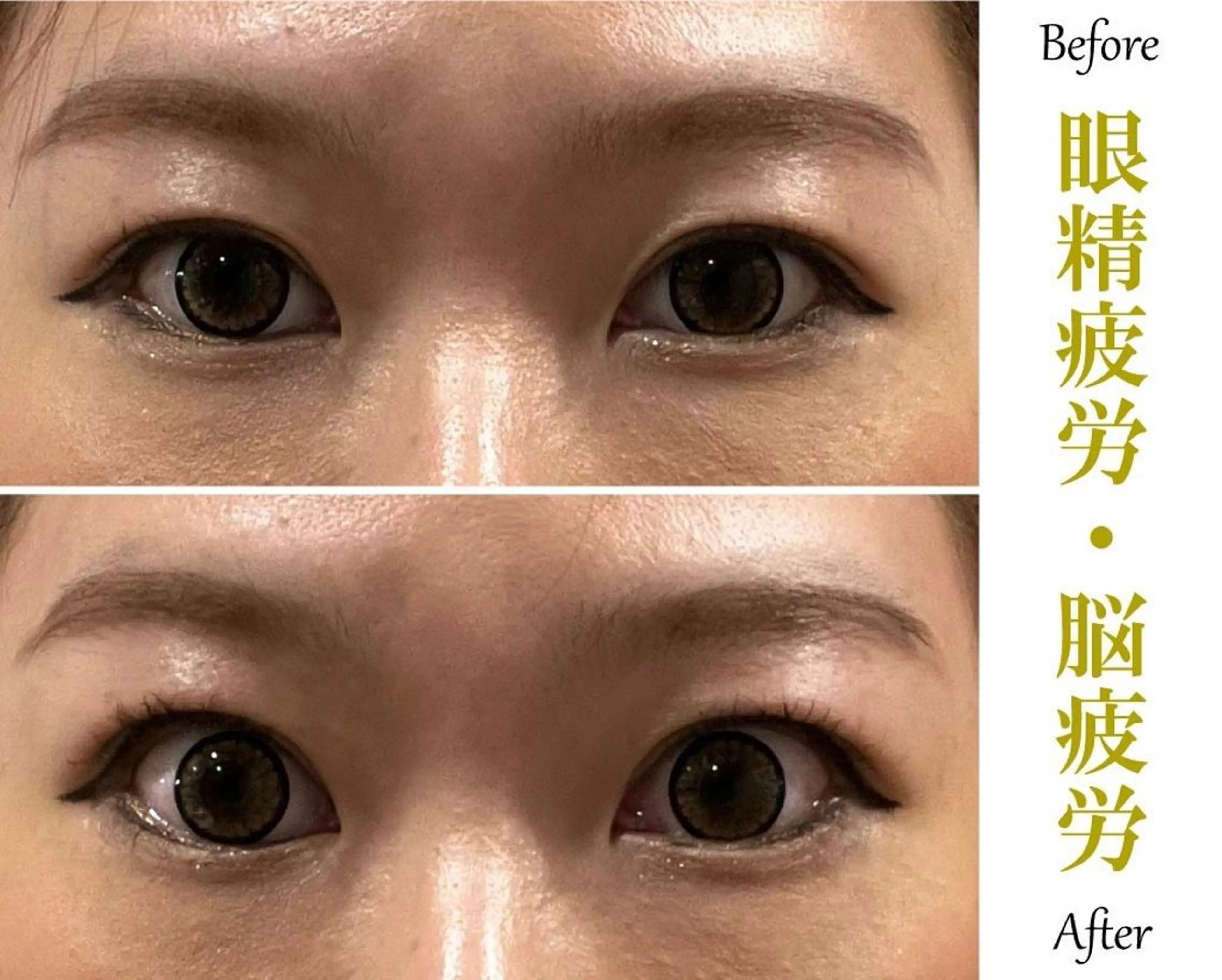 エステ リラク 痩身×フェイシャル ブライダル|Linoのエステ・リラクイメージ