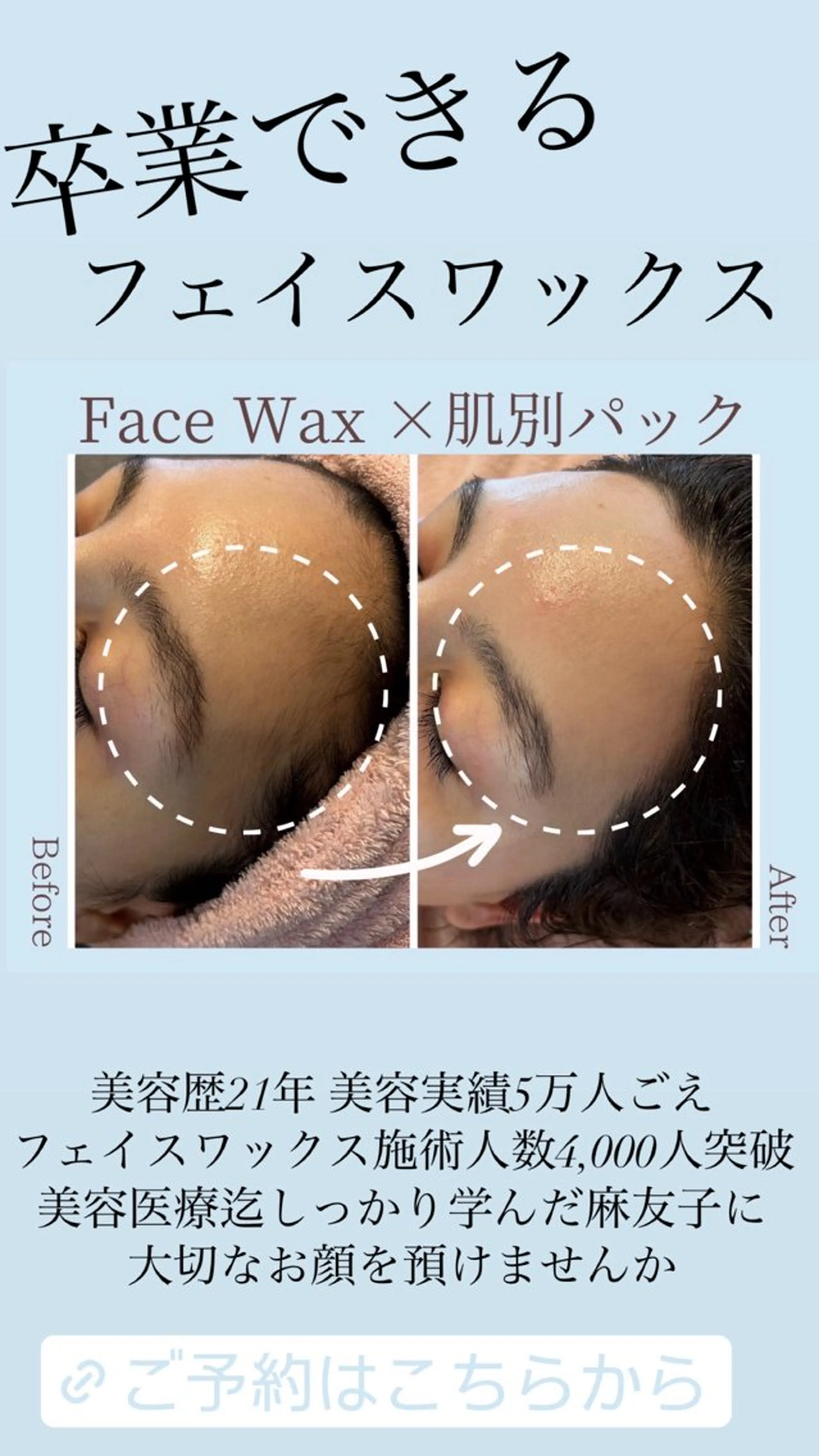 Detox Salon〜Lani Blue〜所属・卒業できるフェイス ワックス専門店のエステ・リラクイメージ