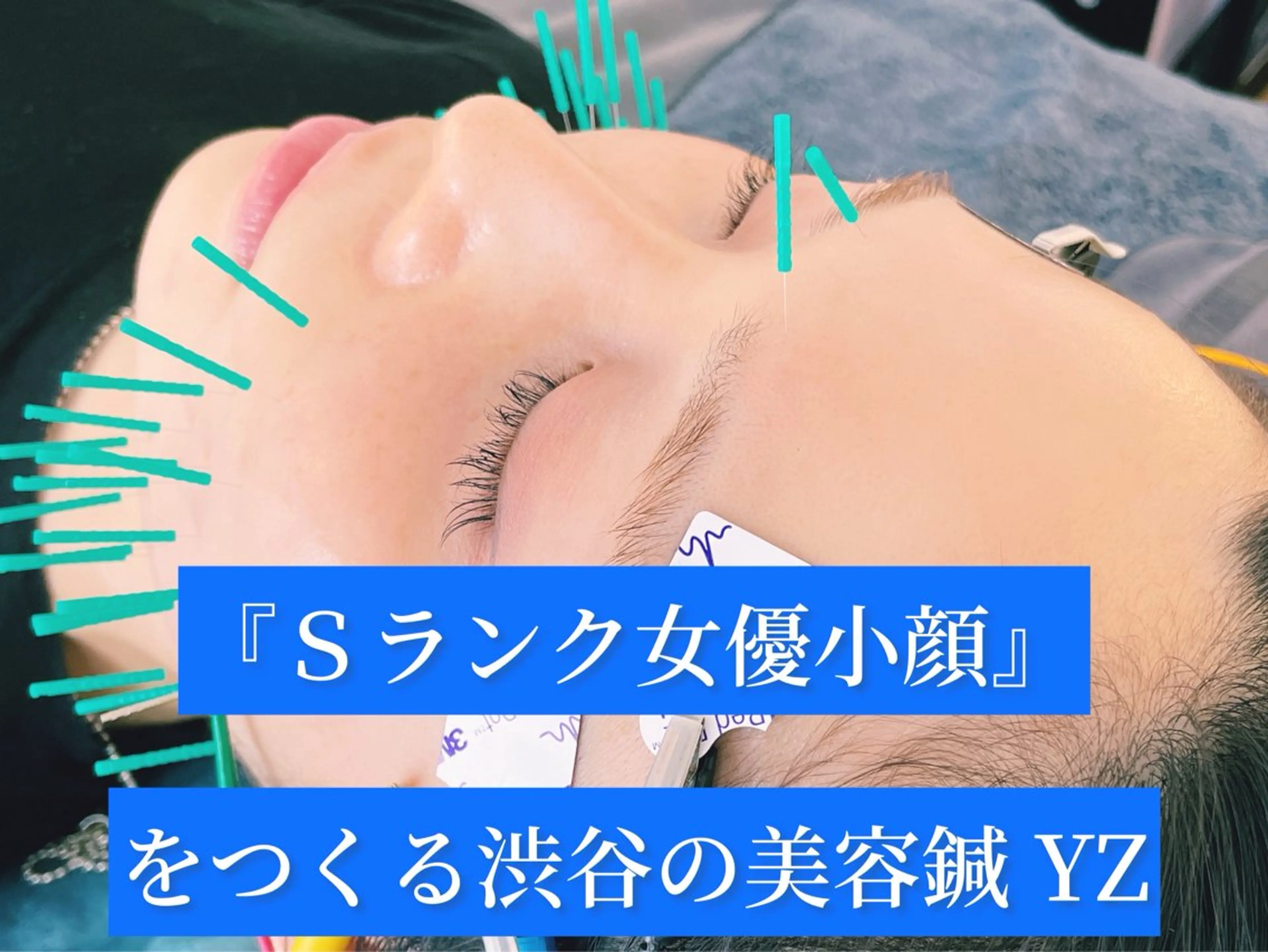 撮影モデル 小顔美容鍼専門サロン 渋谷YZのエステ・リラクイメージ