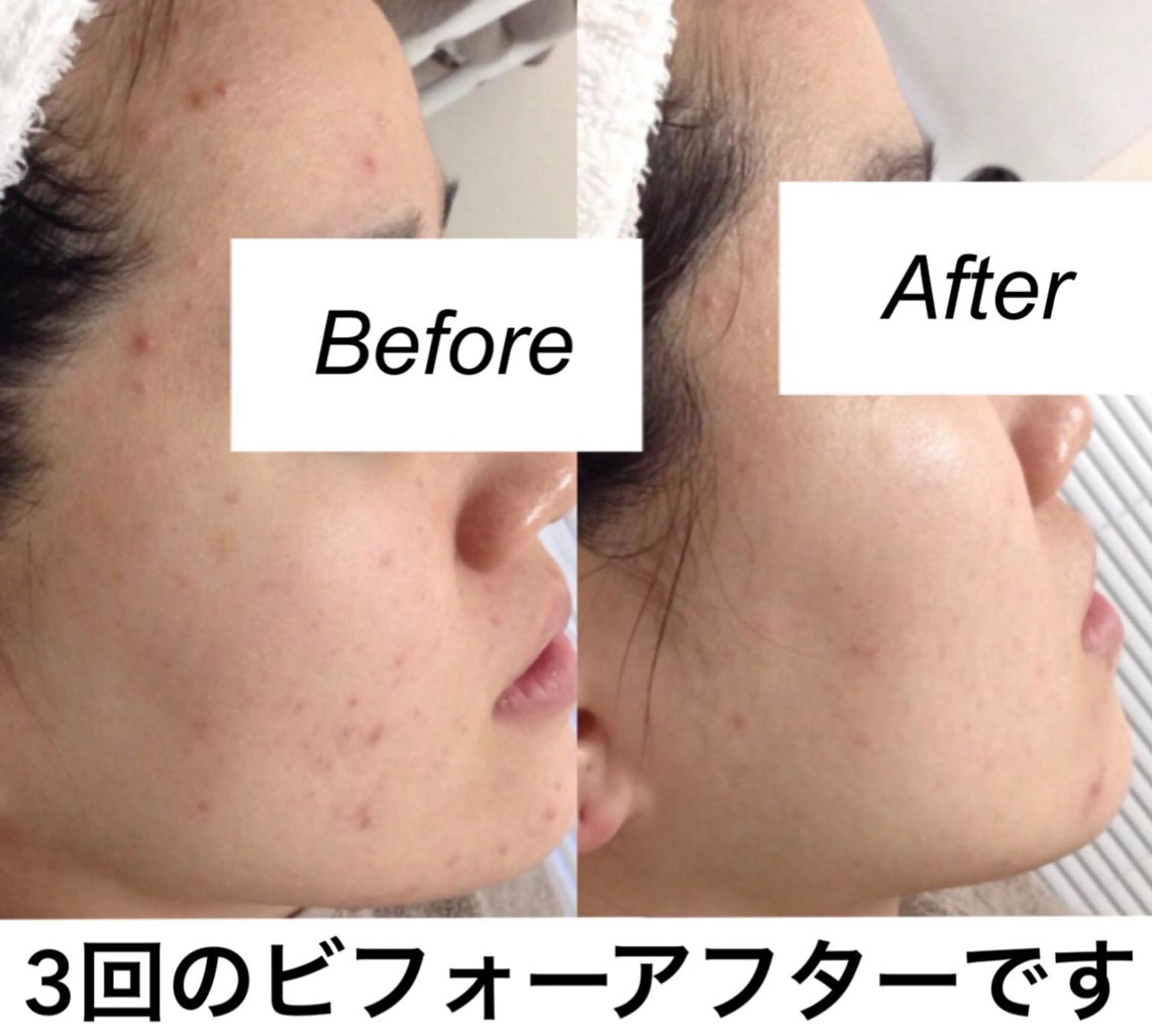 エステ リラク 都度払い肌質改善 &脱毛Blancheのエステ・リラクイメージ