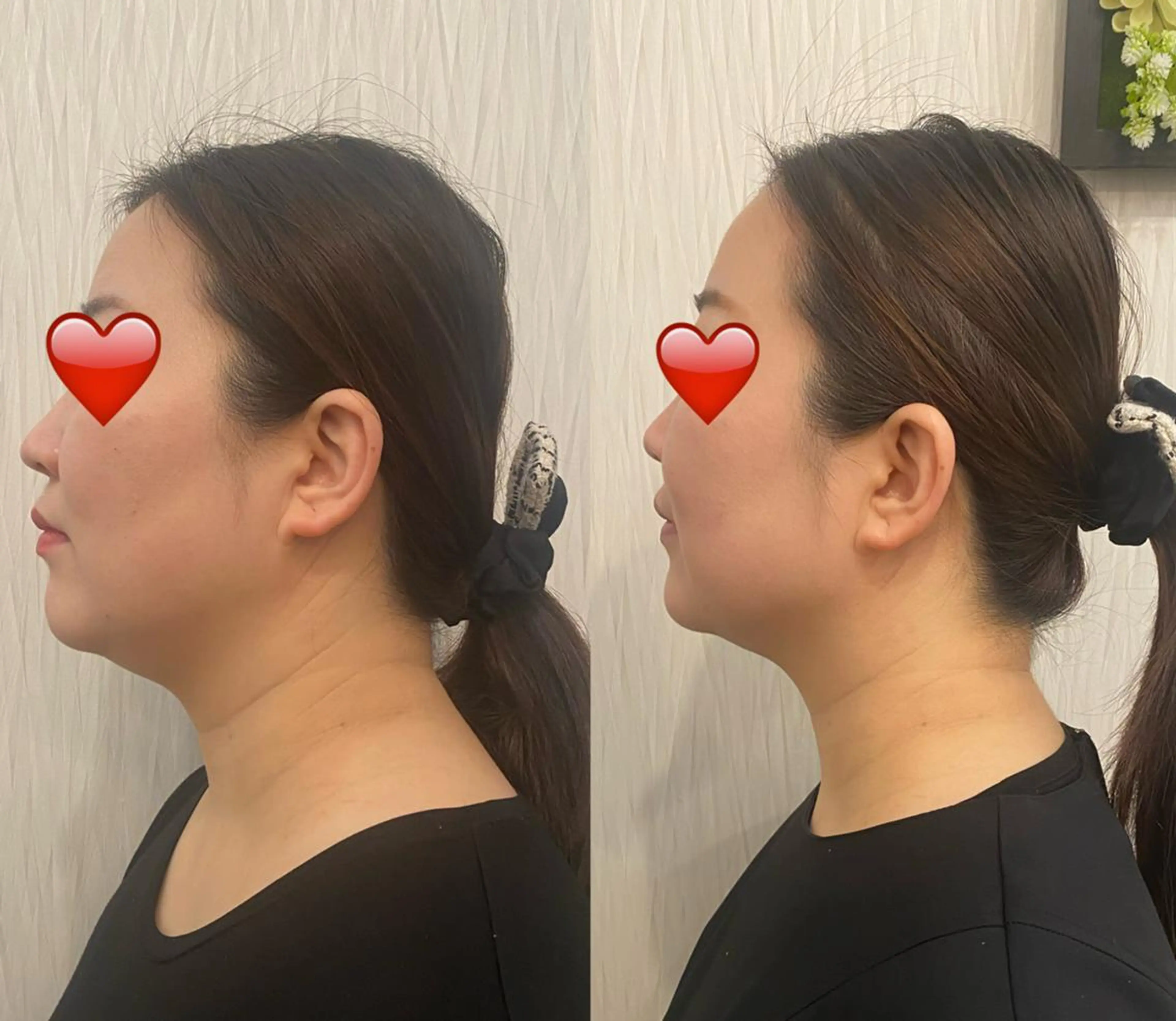 エステ OPREA 千種店のエステ・リラクイメージ