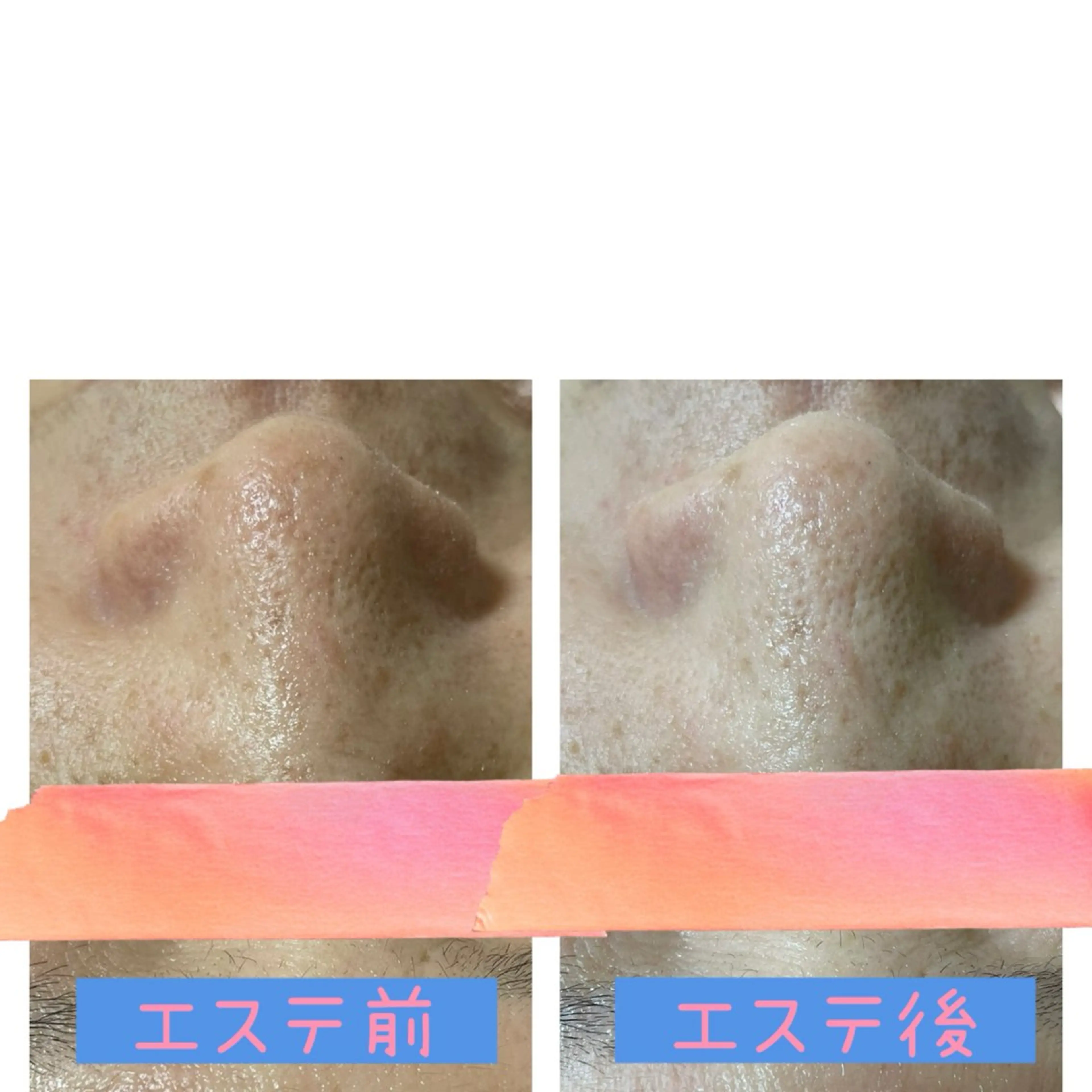 エステ 癒し×小顔×毛穴ケア サロンSourilのエステ・リラクイメージ