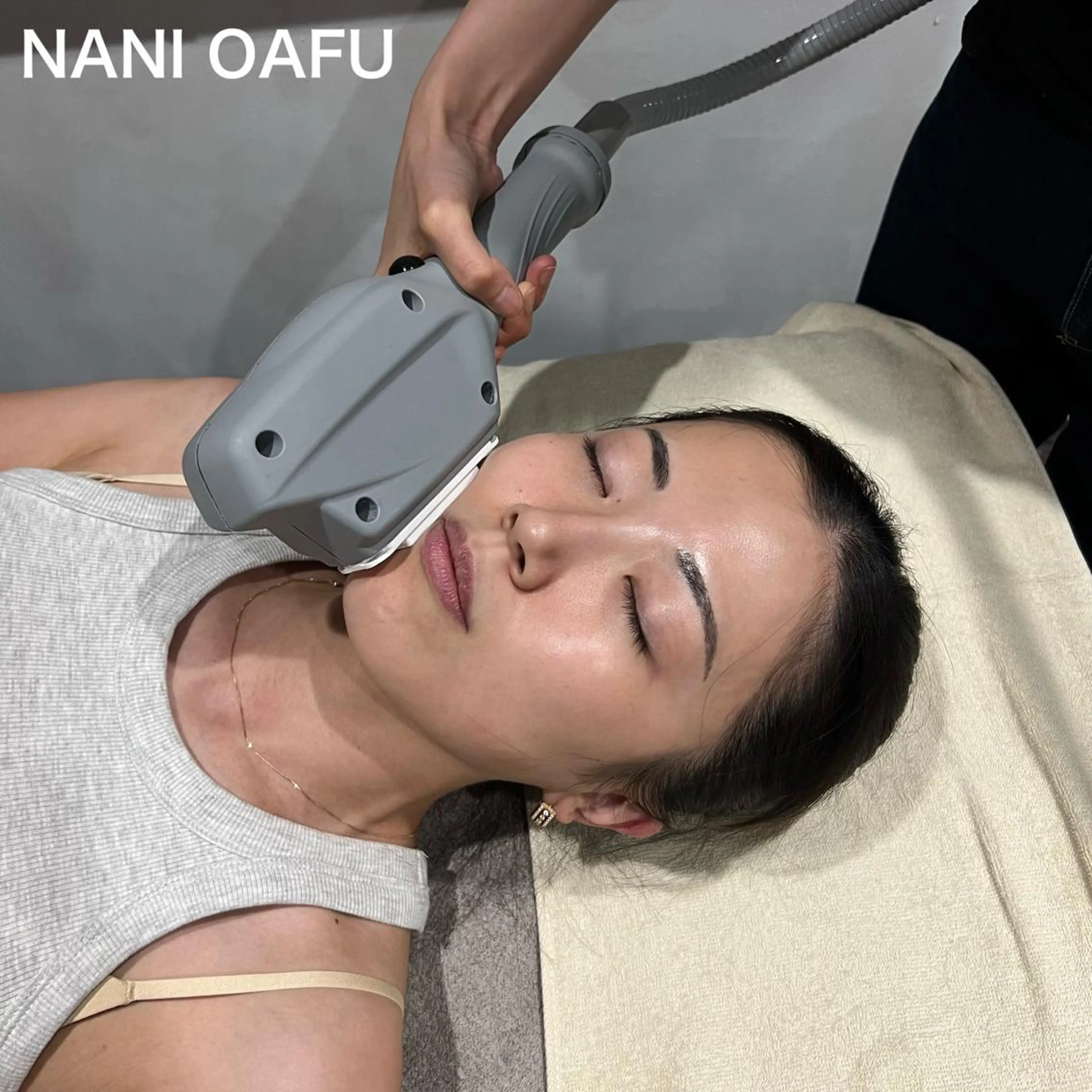 【MEN’Sフェイス脱毛🧔‍♂️🫧】ヒゲ＋口周り＋フェイスライン｜毛穴引き締め×美肌仕上げ◎レディースもOK✨の写真