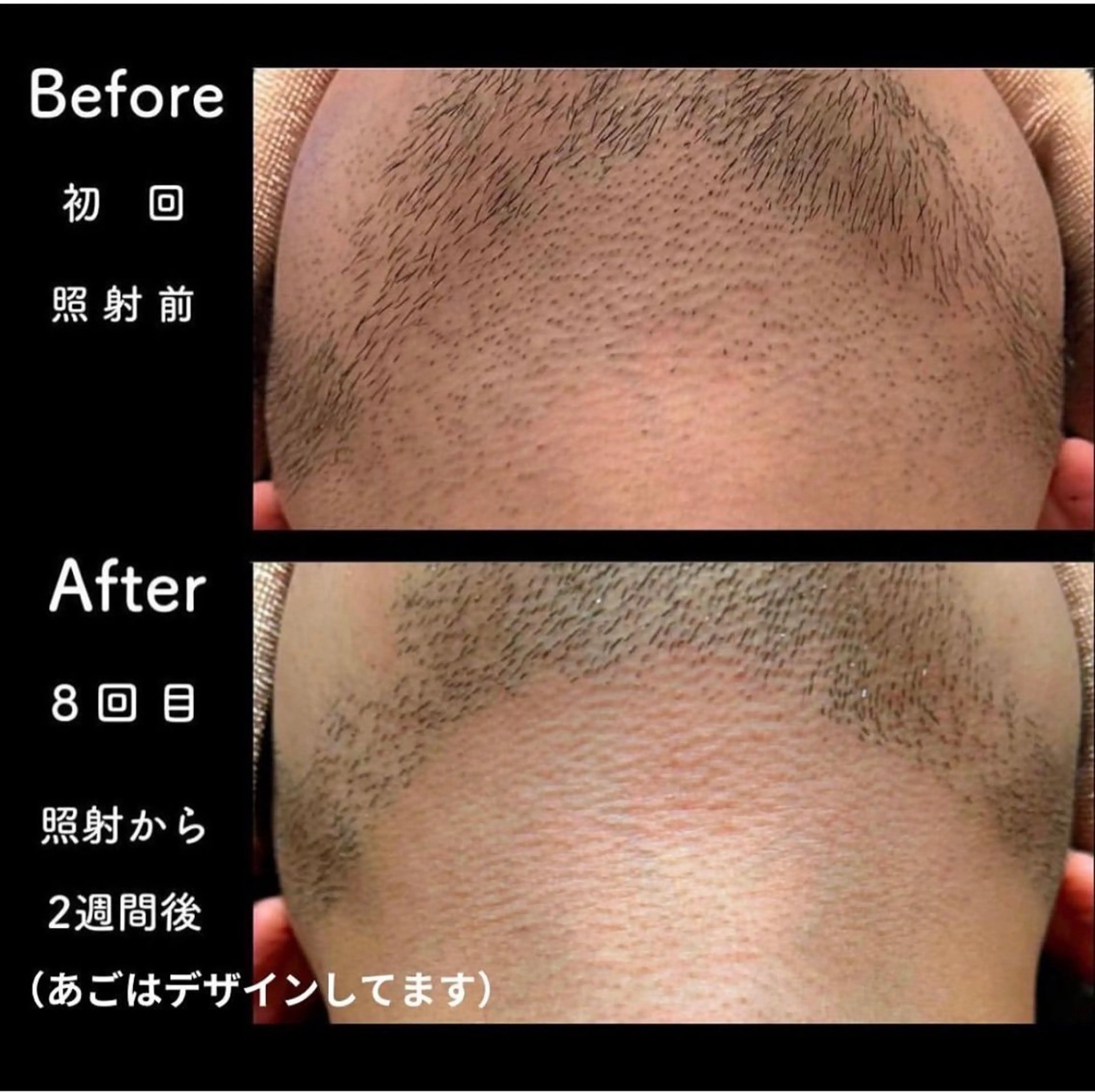 メンズ 脱毛 self salon ～輪～のその他イメージ