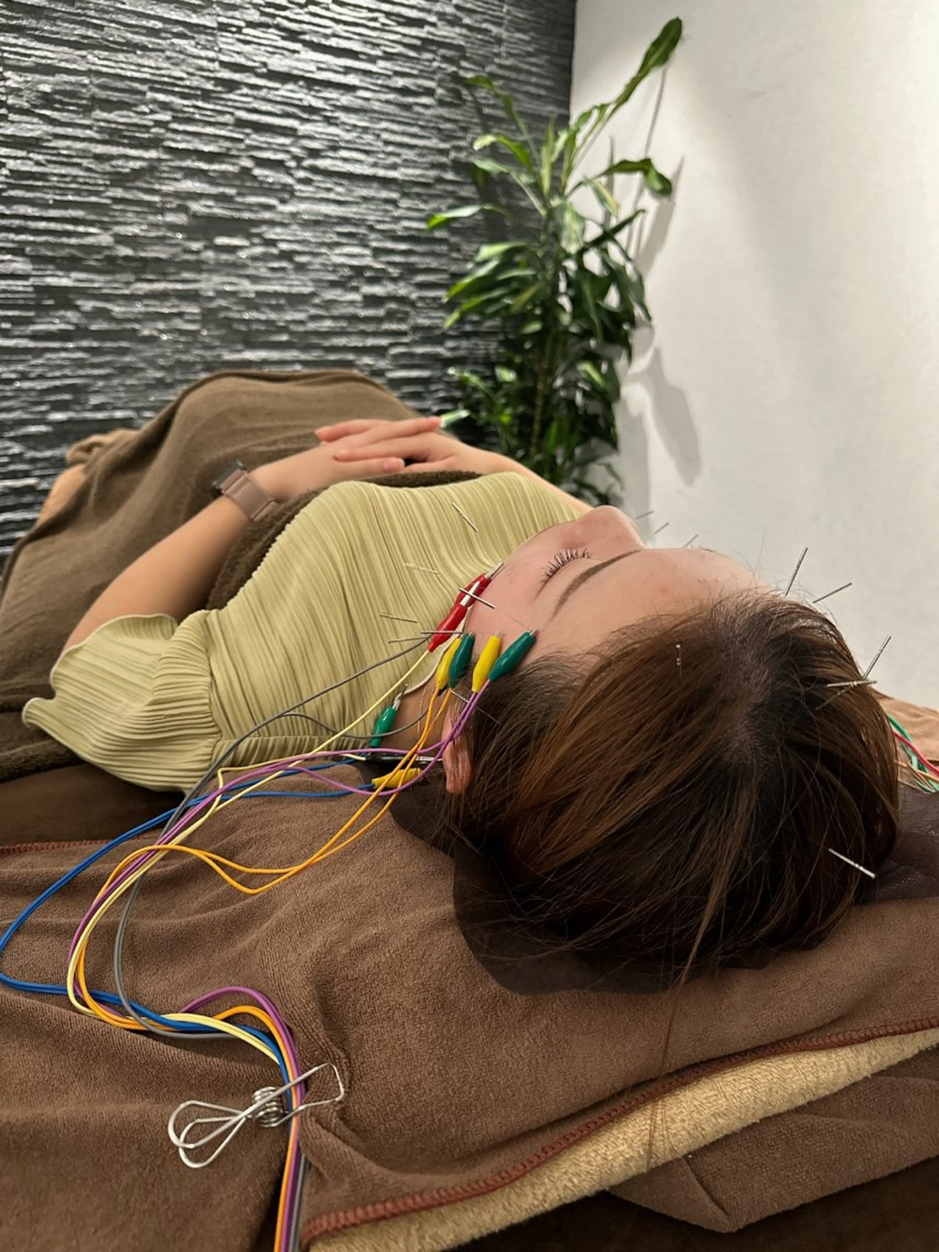 その他 美容鍼灸整体サロンBeauJu所属・小顔/美容鍼専門 BeauJuのその他イメージ