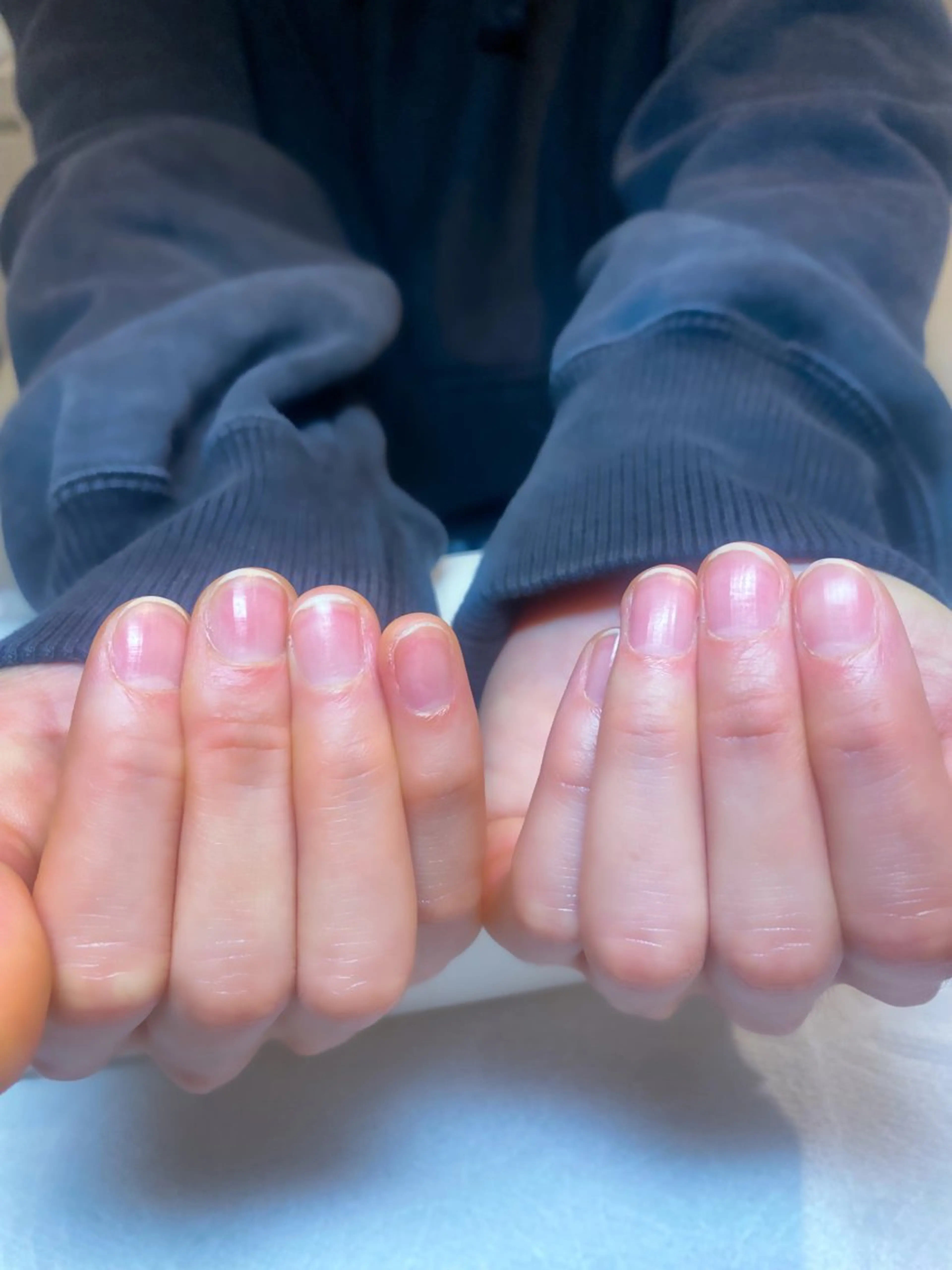 ナチュラル美爪ケアの写真