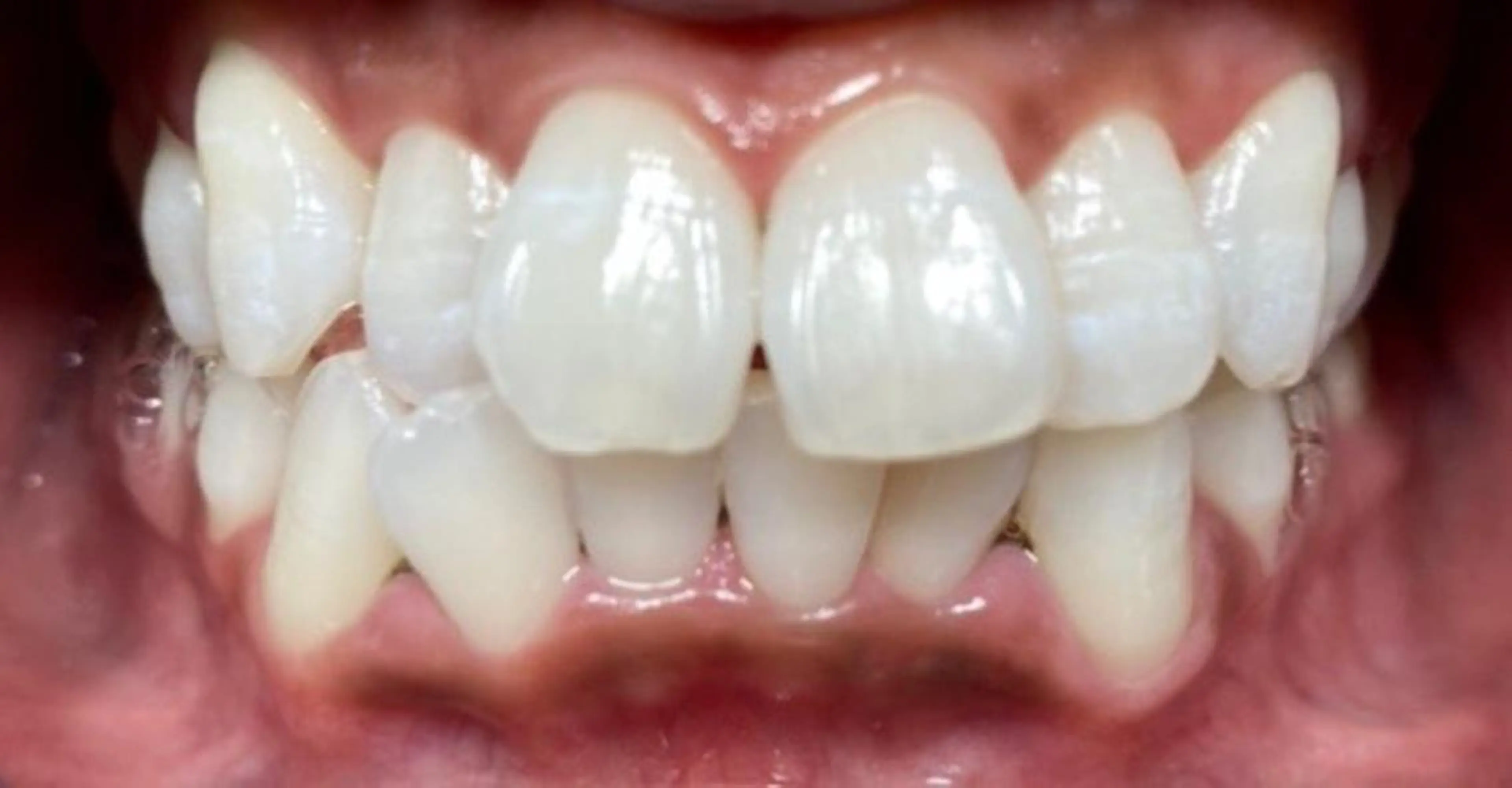 セルフホワイトニングサロン　ラヴィアン所属・ホワイトニングサロン La vie enのその他イメージ