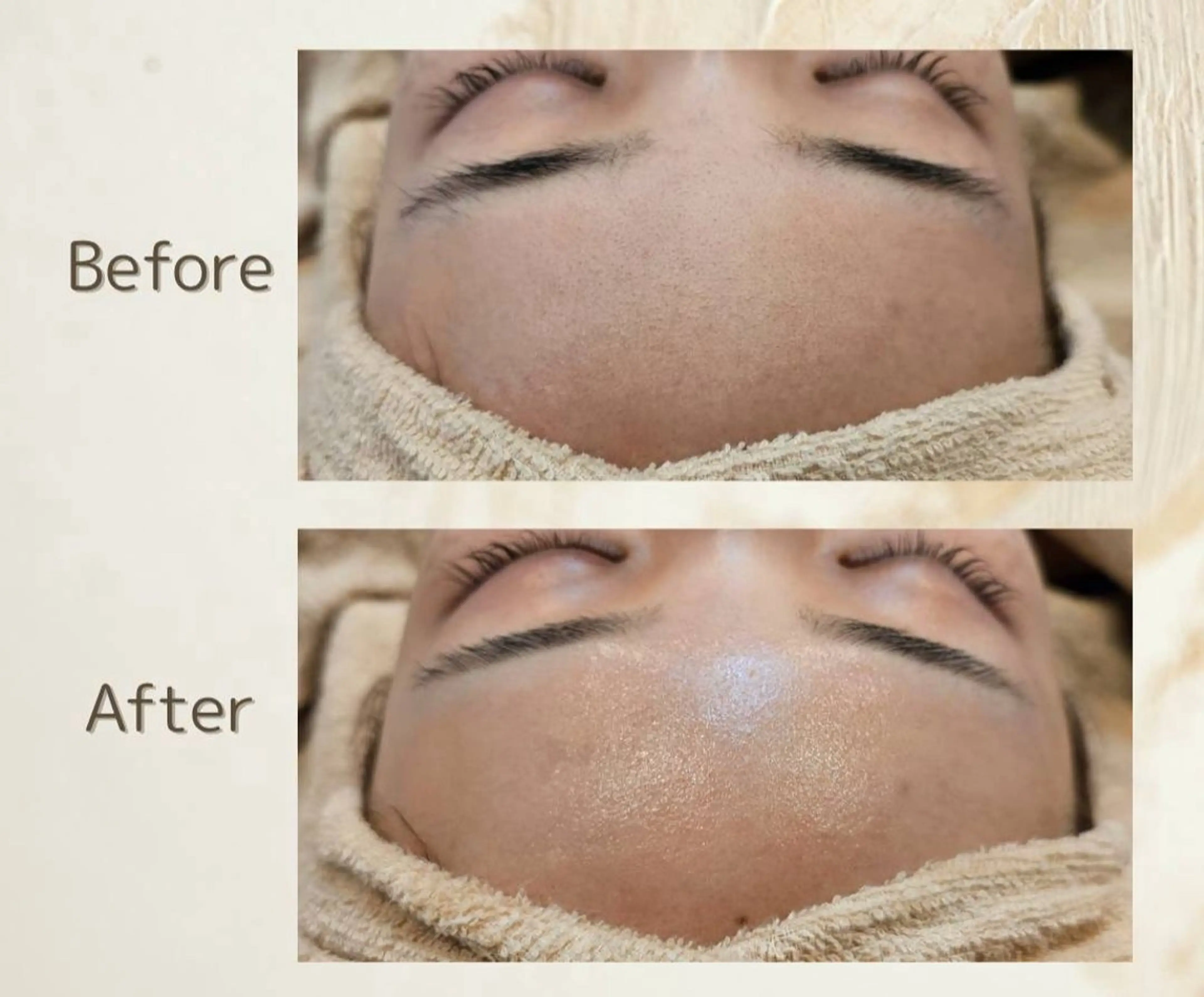 【学割U24】ツヤ肌フェイスシェービングの写真