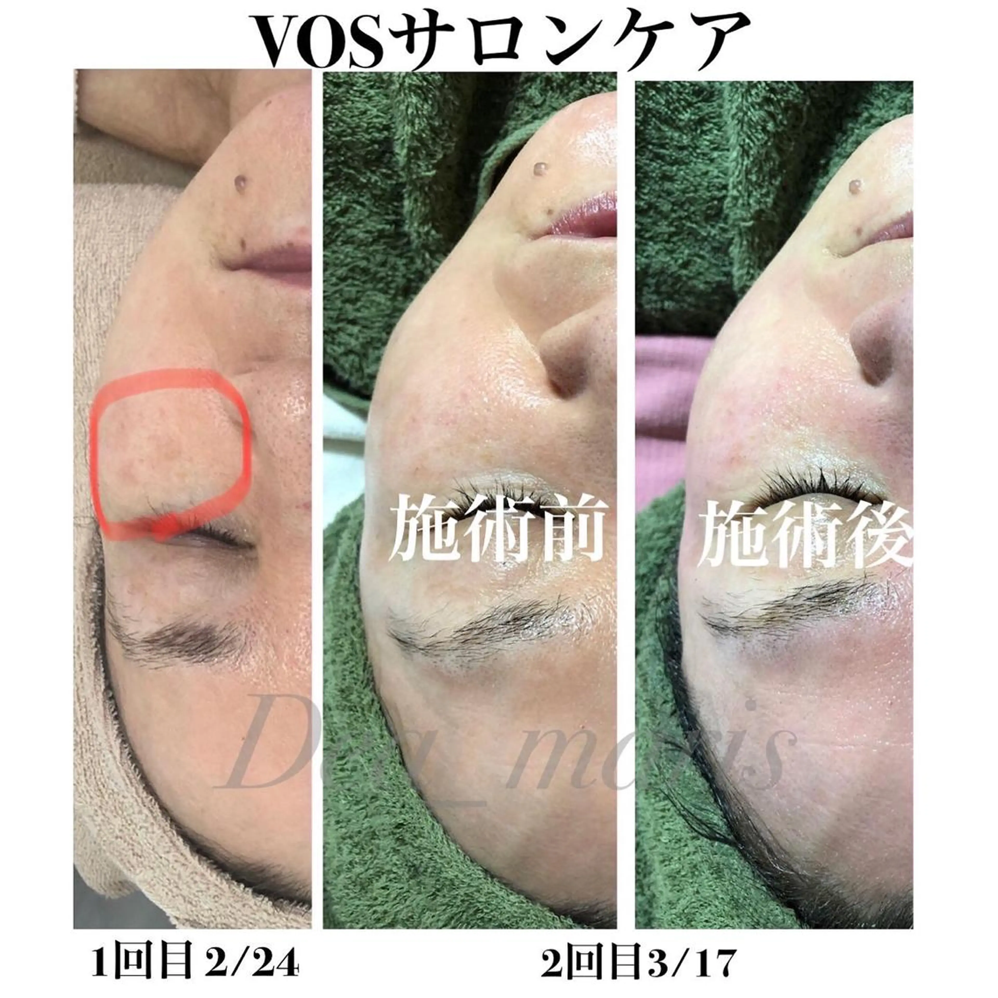 private salon  Dea_maris シュガーリング＆パーソナルボディケア所属・グランプリ受賞👑肌 体も別人級に変えるのエステ・リラクイメージ