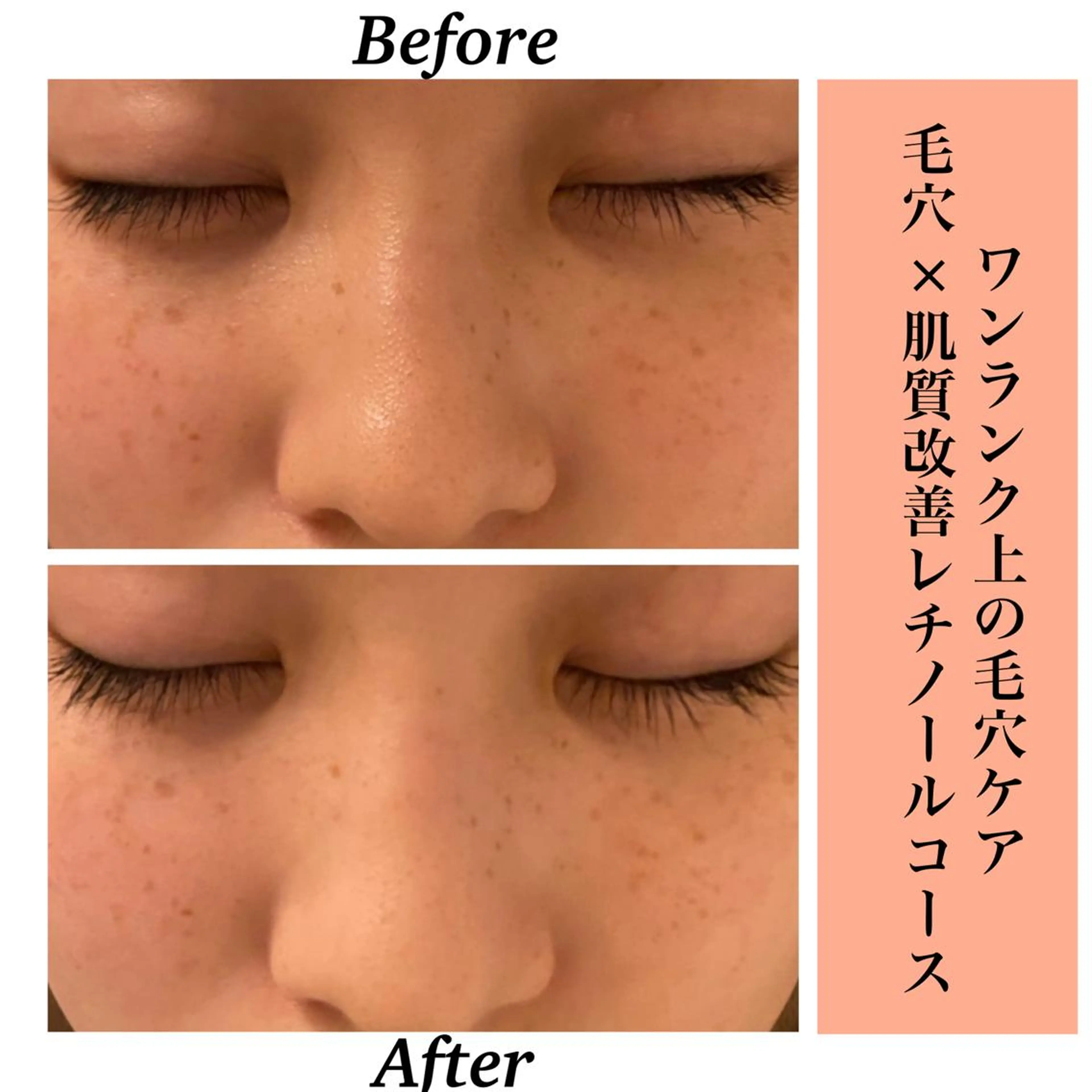 エステ リラク Bellesthe (ベルエステ)のエステ・リラクイメージ