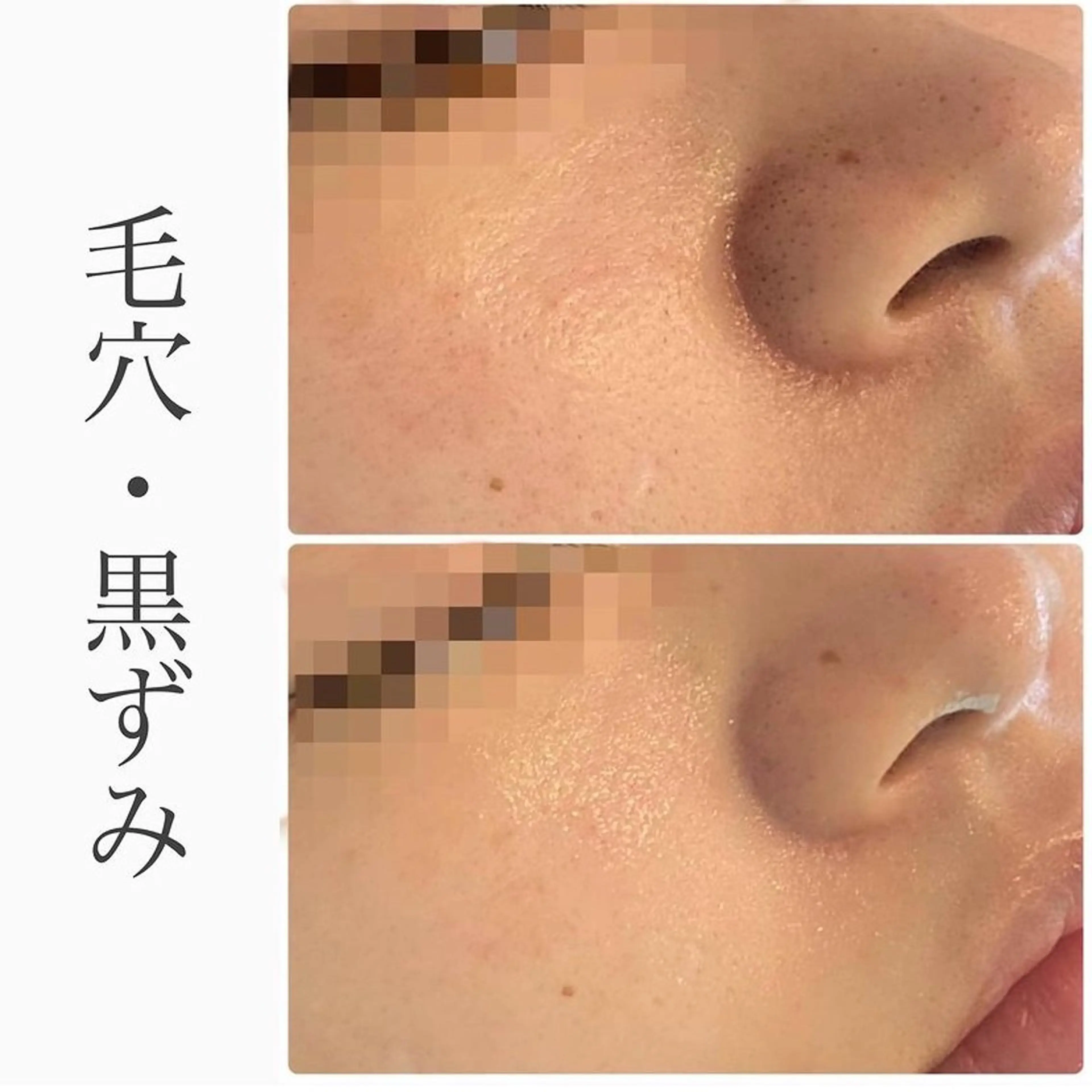 ハーブピーリング専門 BIOEL横浜のエステ・リラクイメージ