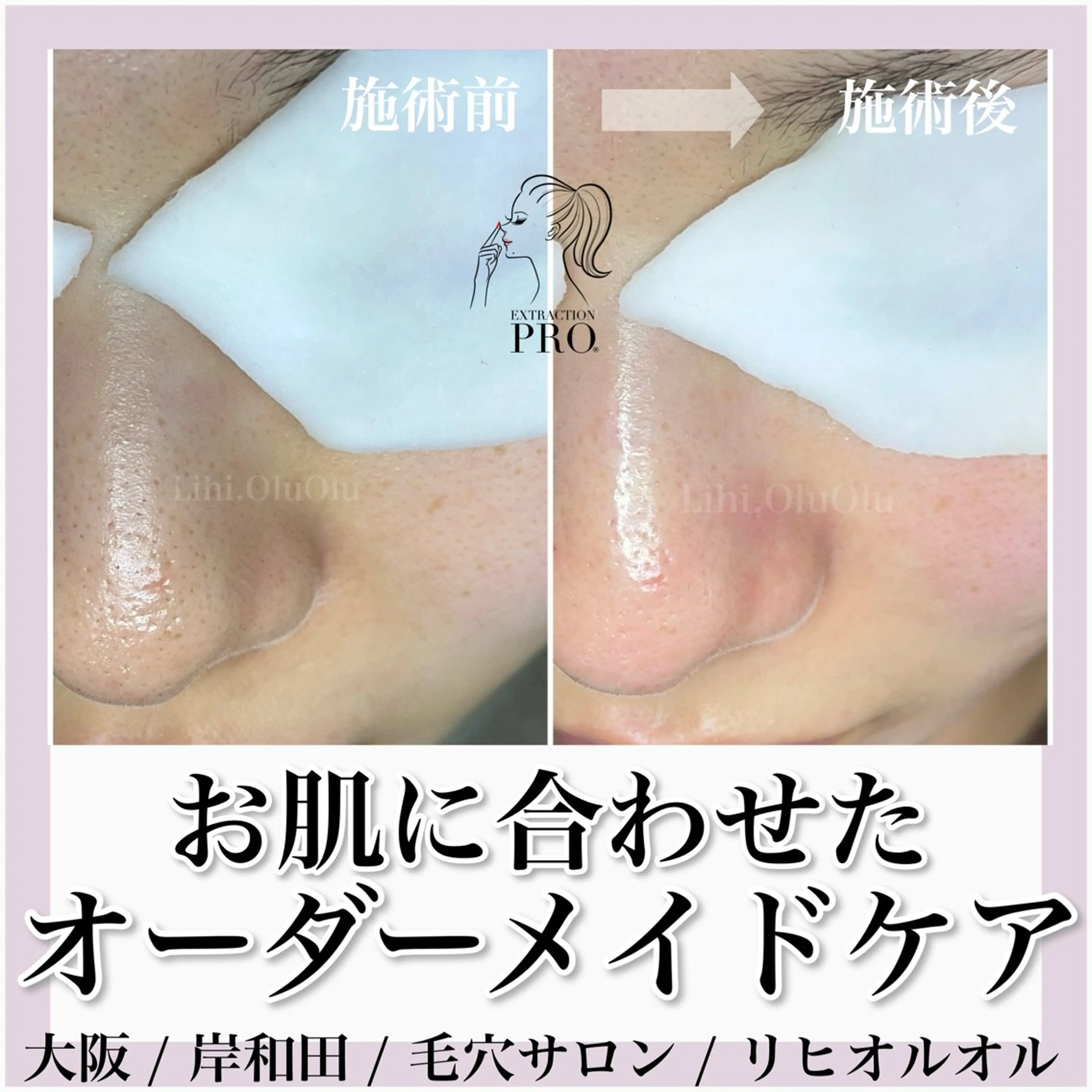 毛穴汚れ改善専門店/ 岸和田/リヒオルオルのエステ・リラクイメージ