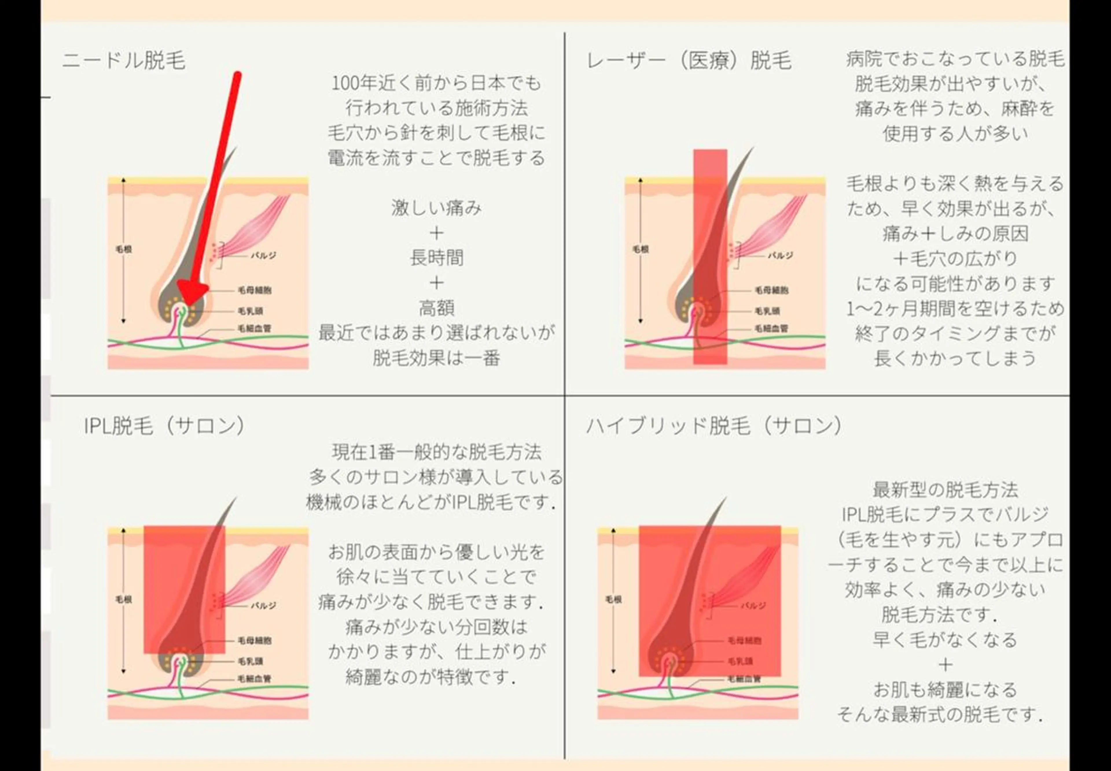 20代から始める脱毛 salonLEPIAのエステ・リラクイメージ