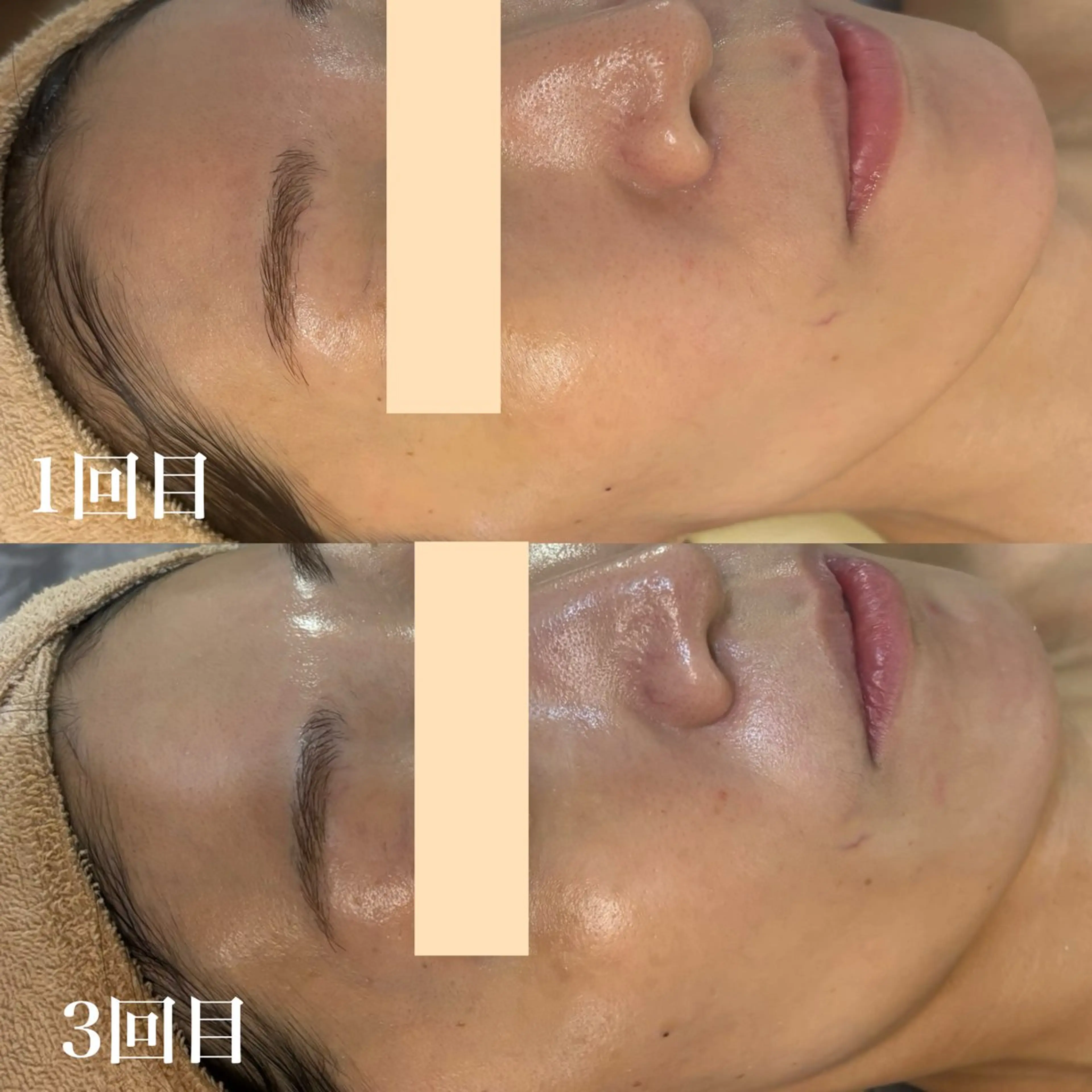 エステ WHITE AQUA 北千住店のエステ・リラクイメージ