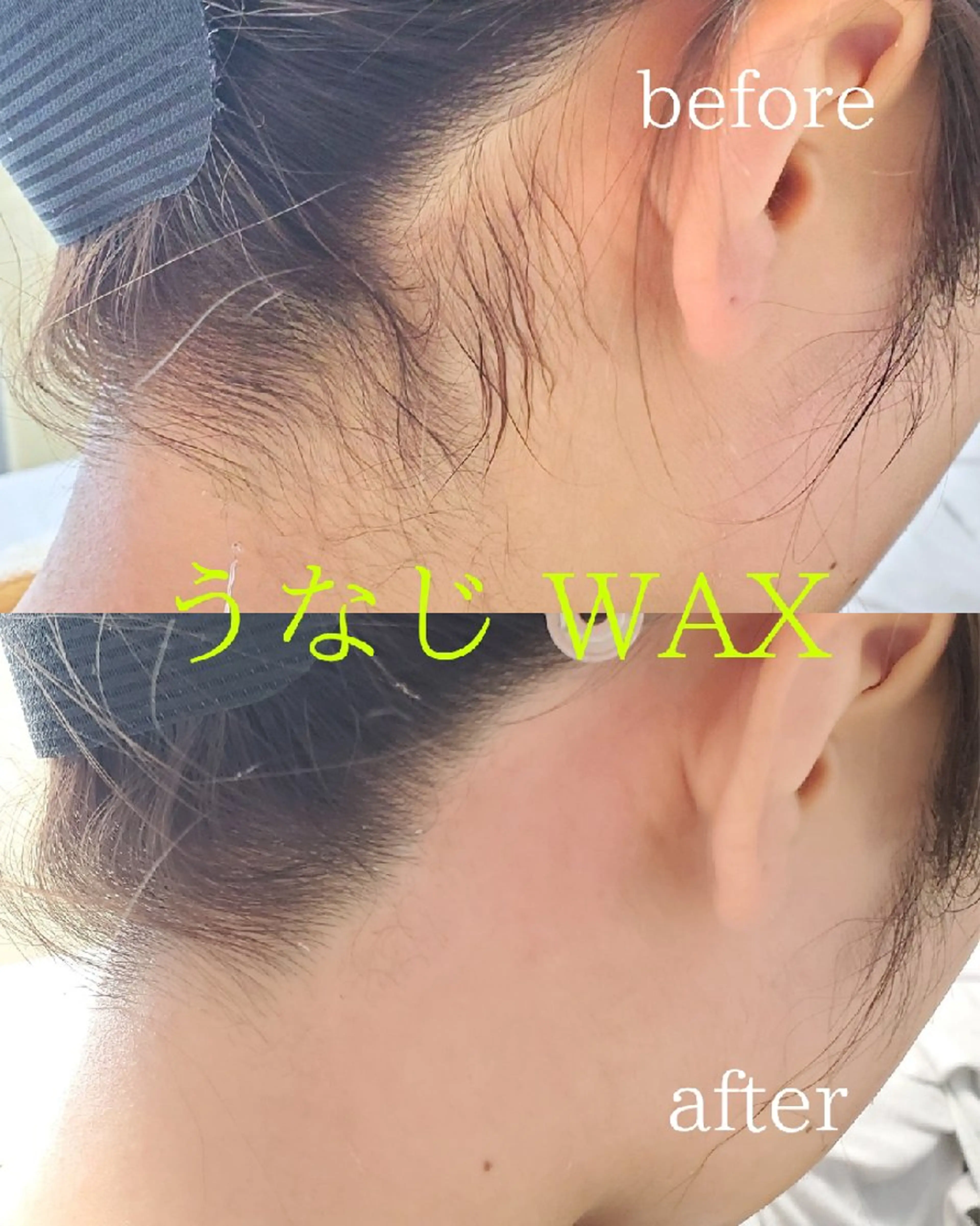 夏準備！ツルツヤ 美肌フェイスワックス全顔+うなじ(鎮静パック付き)の写真