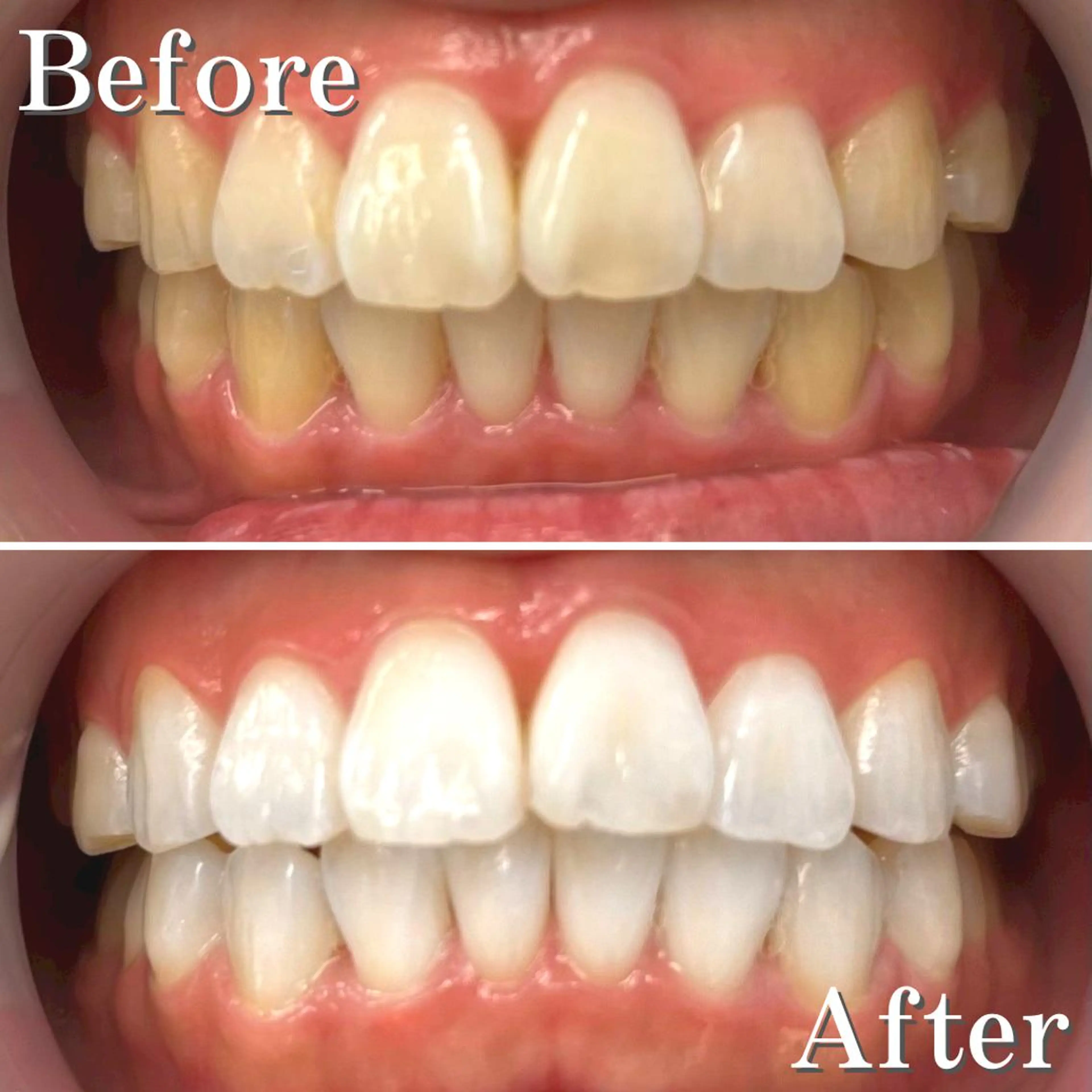 カラー パーマ アイブロウ ネイル マツエク・マツパ メンズ ヘアアレンジ 結婚式・ブライダル メンズアイブロウ 結婚式・ブライダル メンズネイル ブライダルネイル エステ リラク LBSホワイトニング 銀座店💎公式のその他イメージ