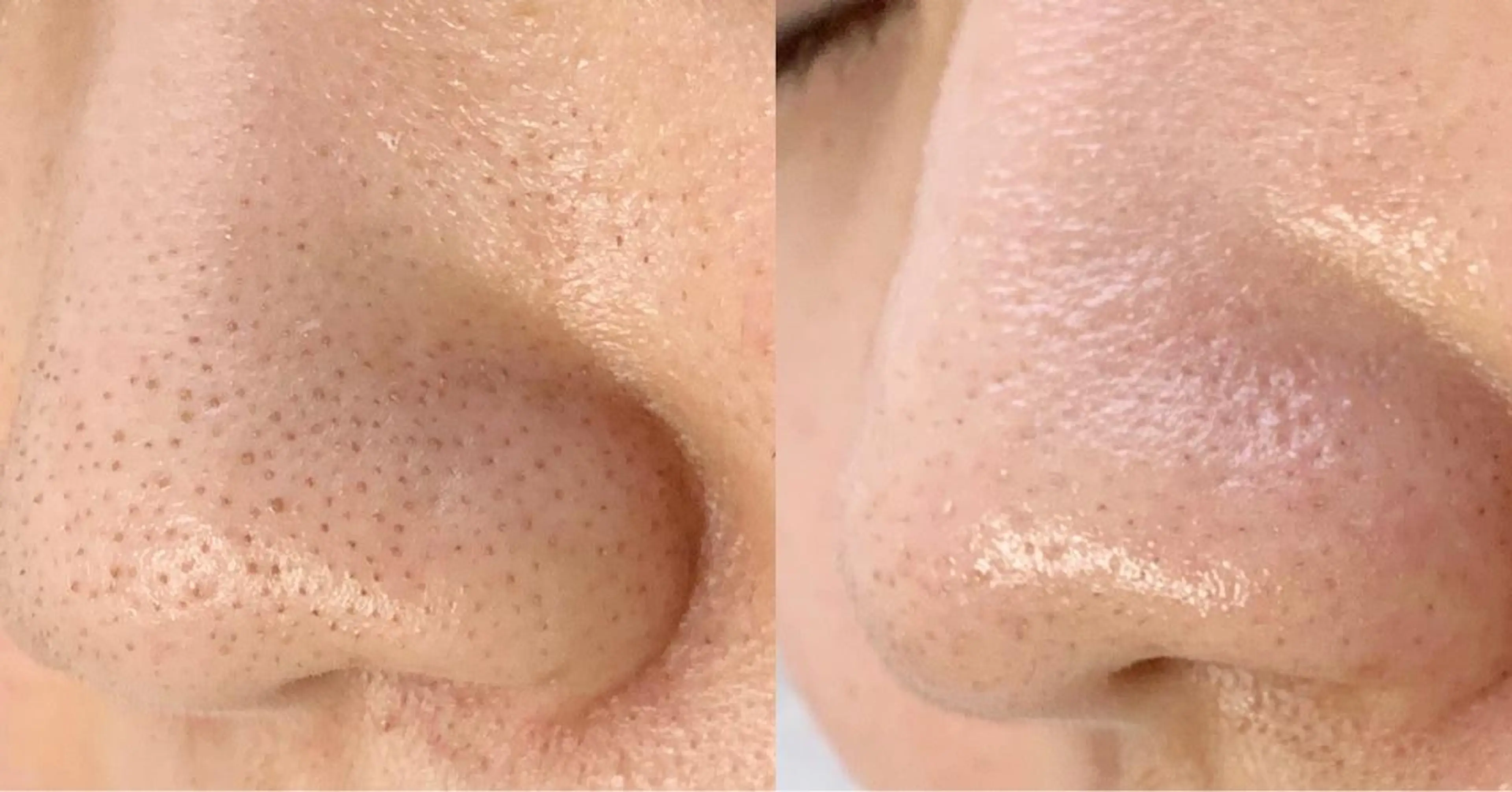 メンズ エステ salonLADYSTYLE所属・稲嶺 美華のエステ・リラクイメージ