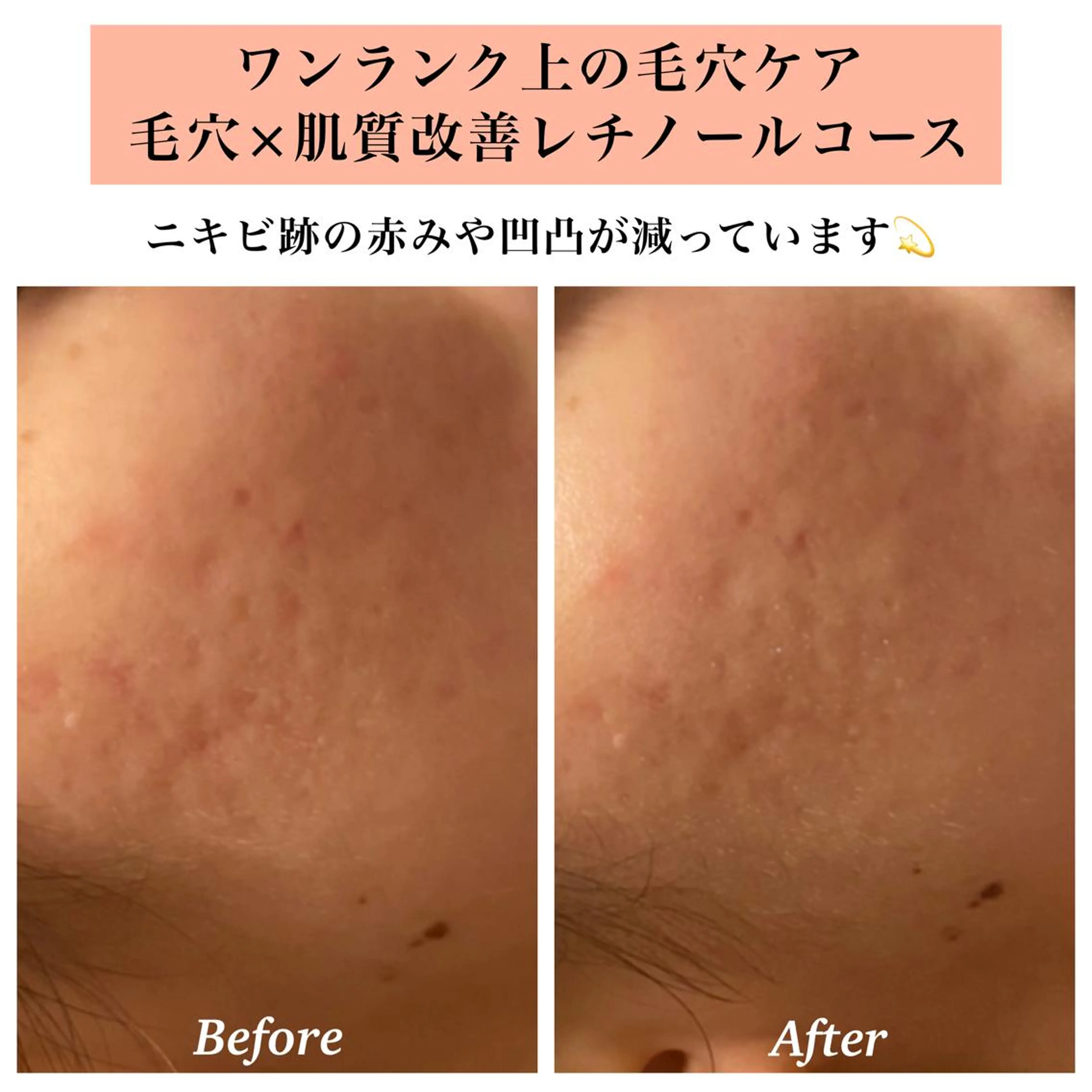 エステ リラク Bellesthe （ベルエステ）のエステ・リラクイメージ