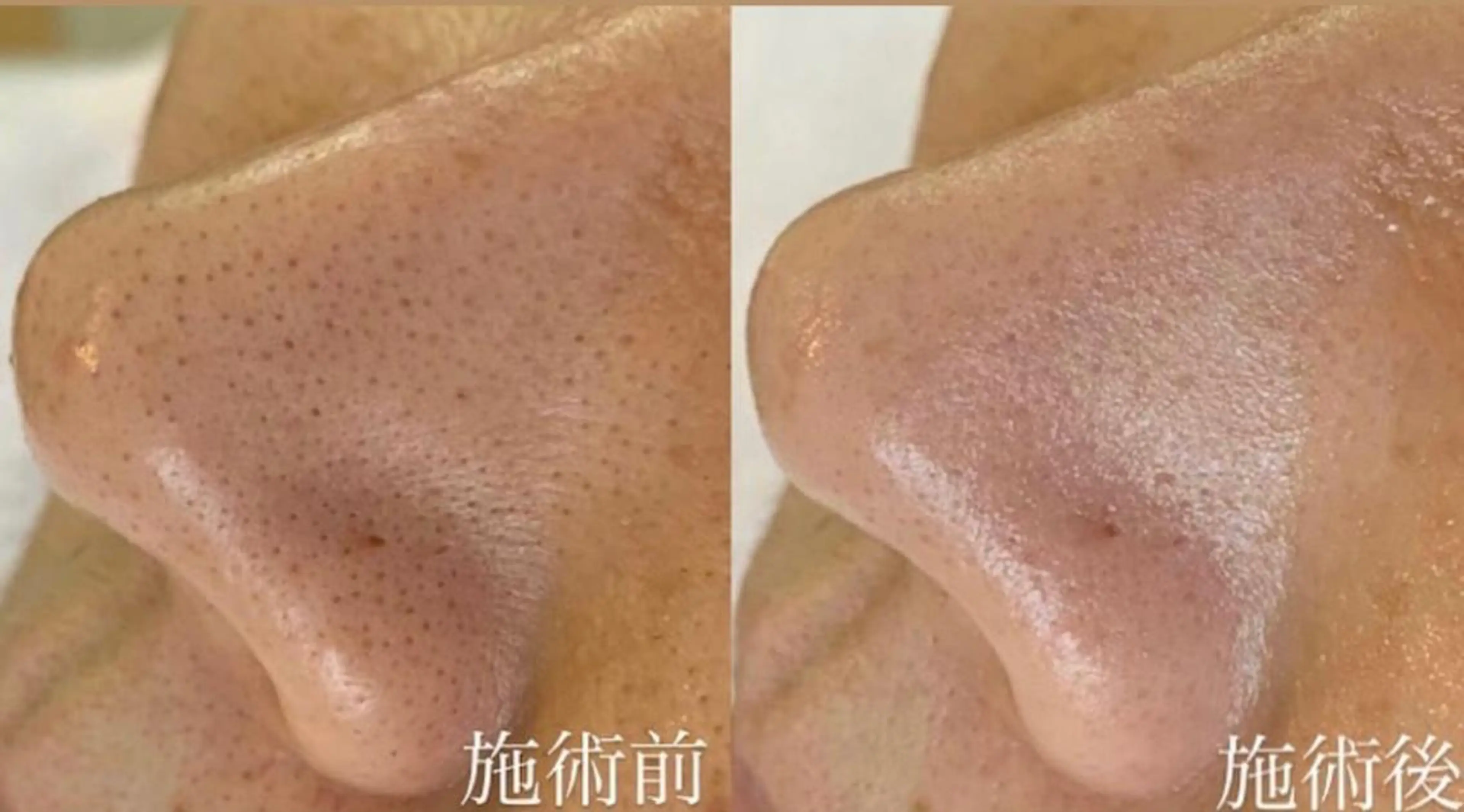 private salon Dea_maris シュガーリング&パーソナルボディケア所属・シミ改善・韓国肌管理 ボディメイク痩身のその他イメージ