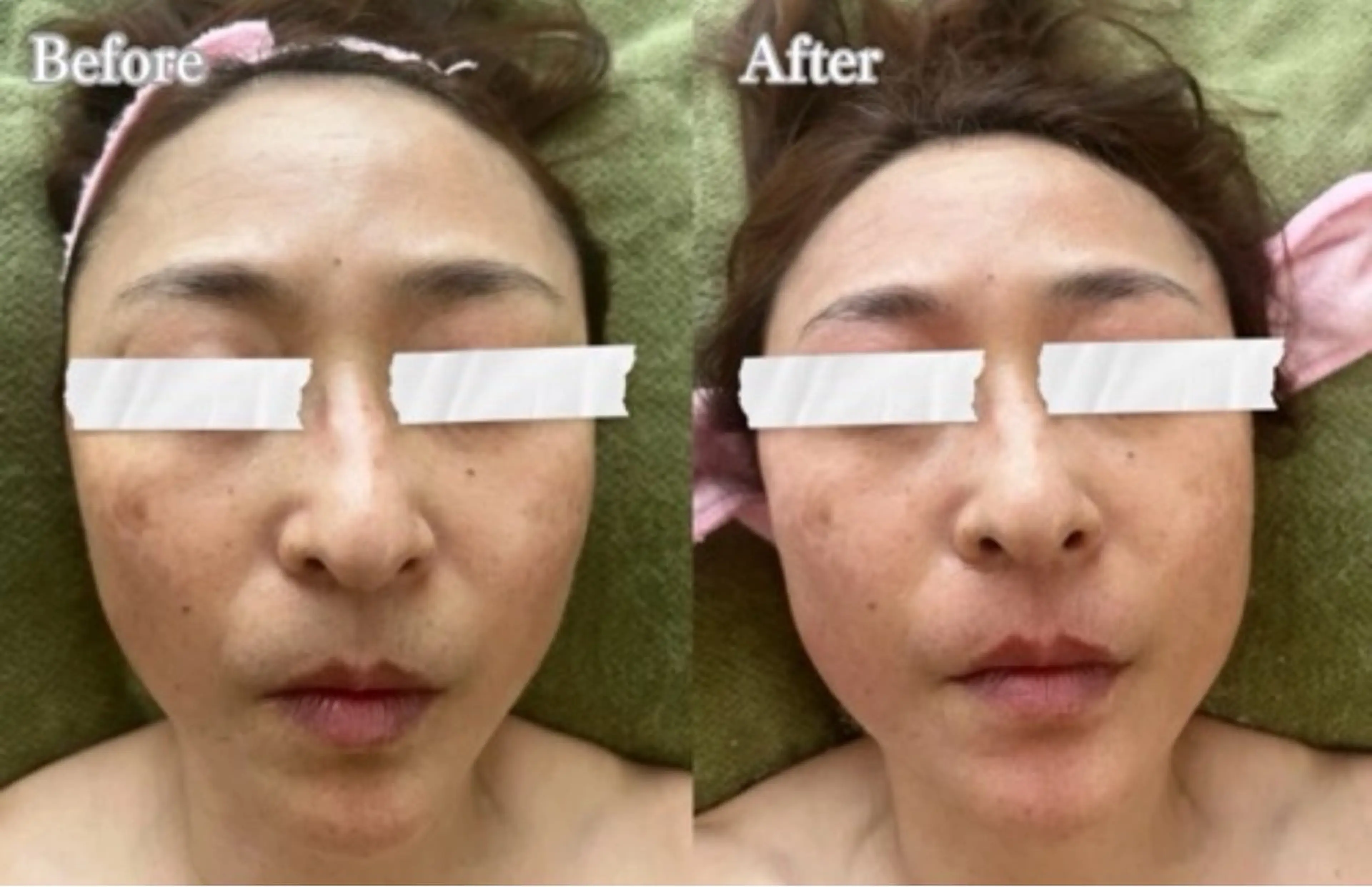 【Salon D】 HALUのエステ・リラクイメージ