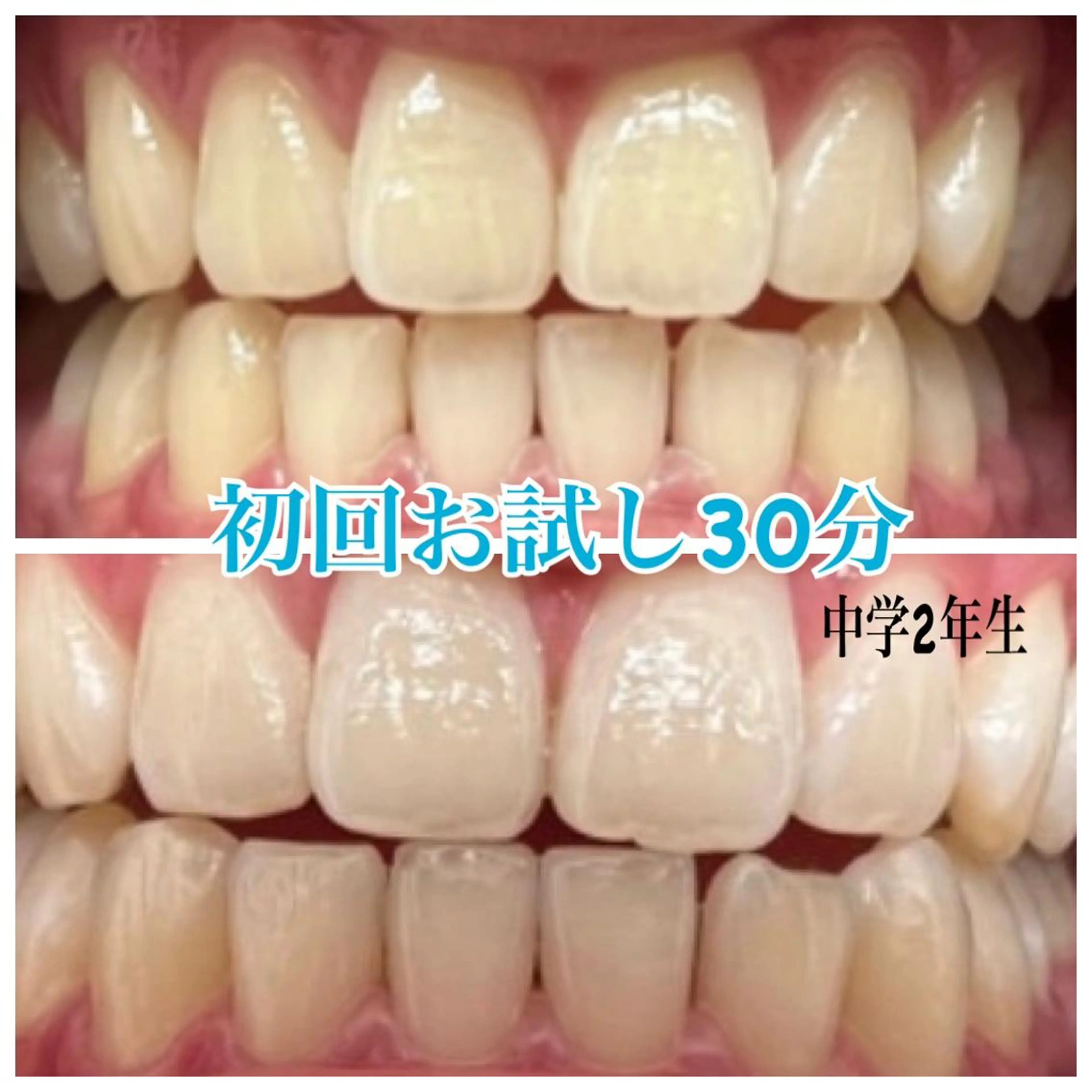 nailsalon   LE'A所属・ホワイトニング🦷 ネイル💅LEAのその他イメージ