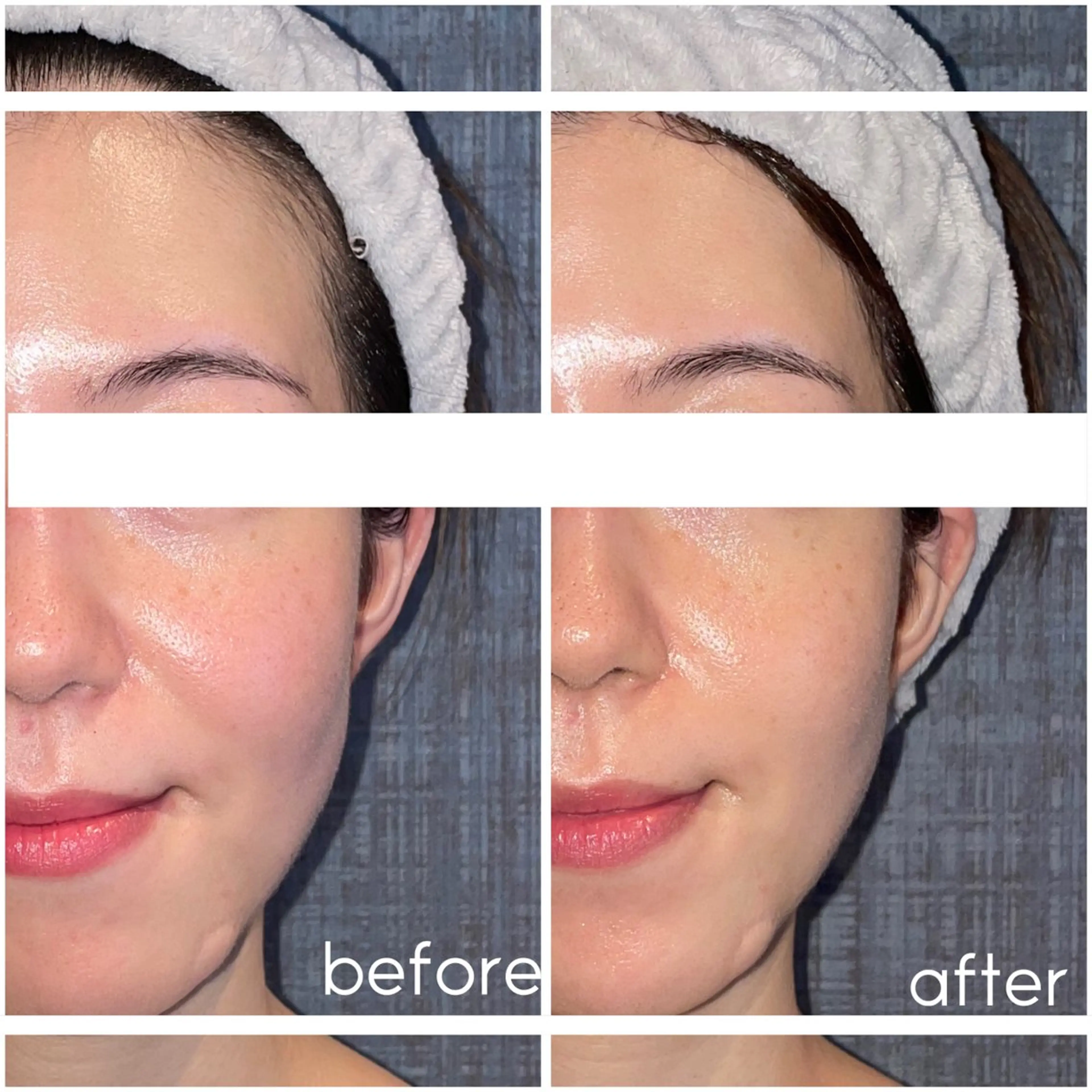 エステ リラク こりとりコルギ専門店MIICO所属・こりとりコルギ専門店 勝　友里奈のエステ・リラクイメージ