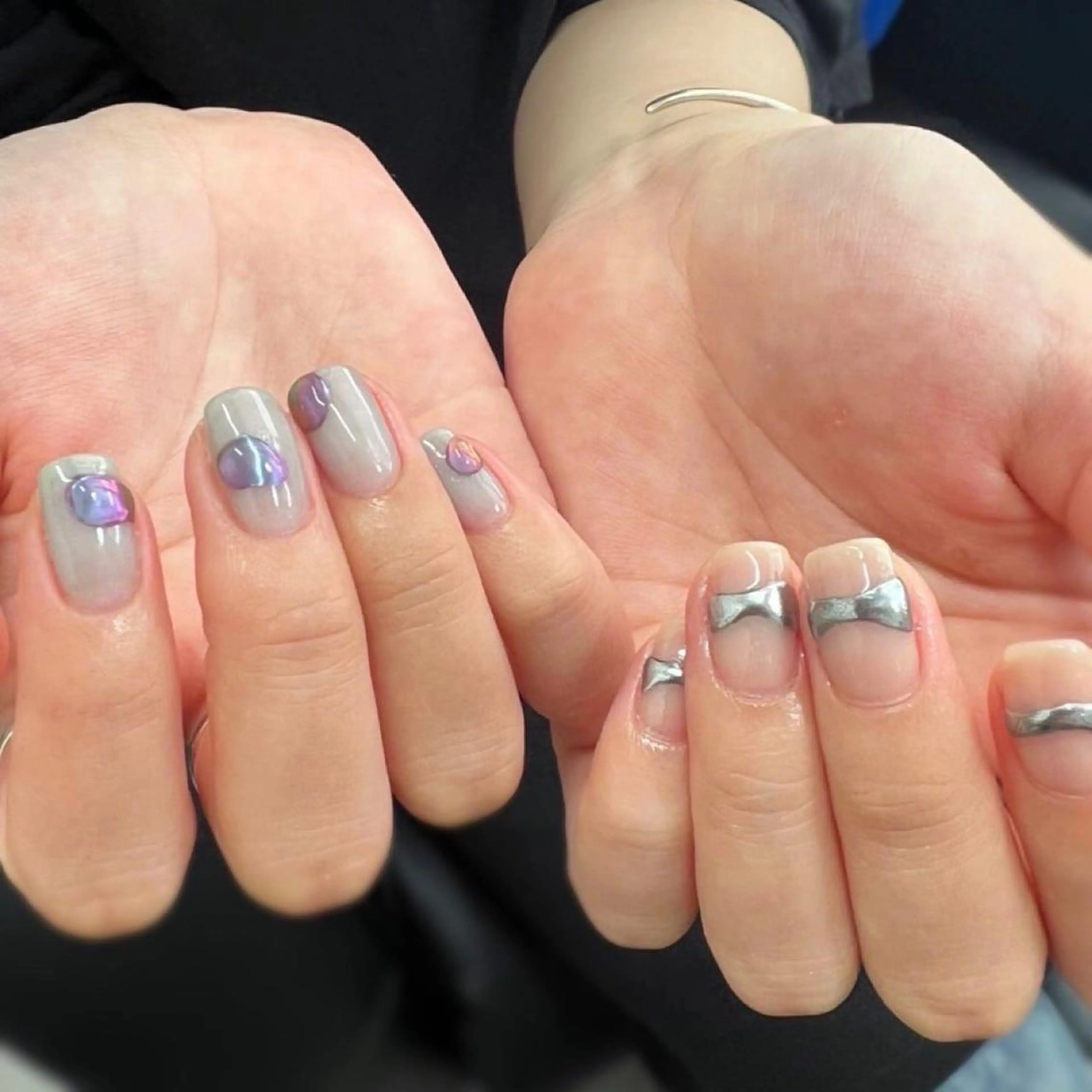 ネイル MAHINA nail所属・MAHINA/ネイル 巻き爪矯正/角質ケアのネイルデザイン