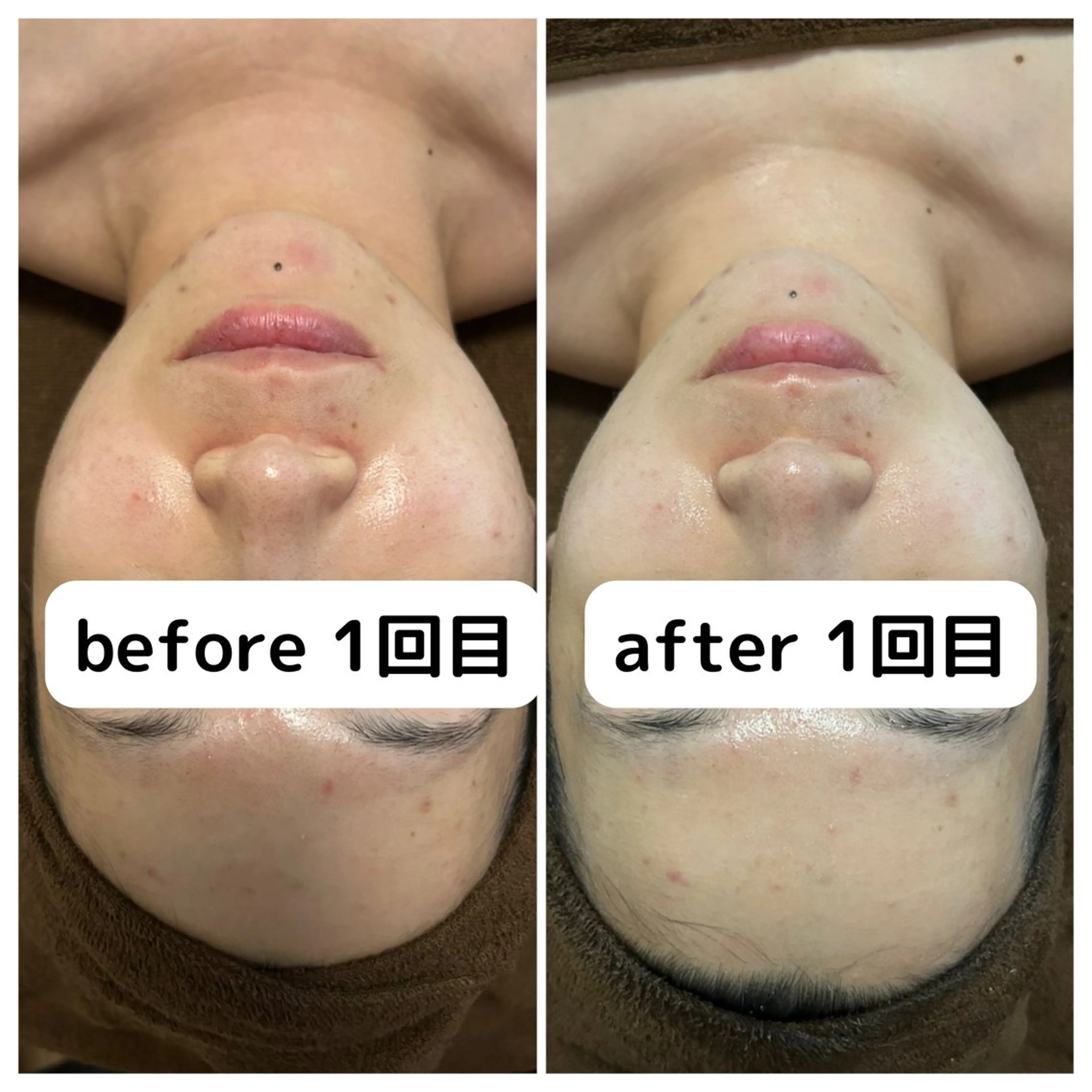エステ 永田 利佳子のその他イメージ