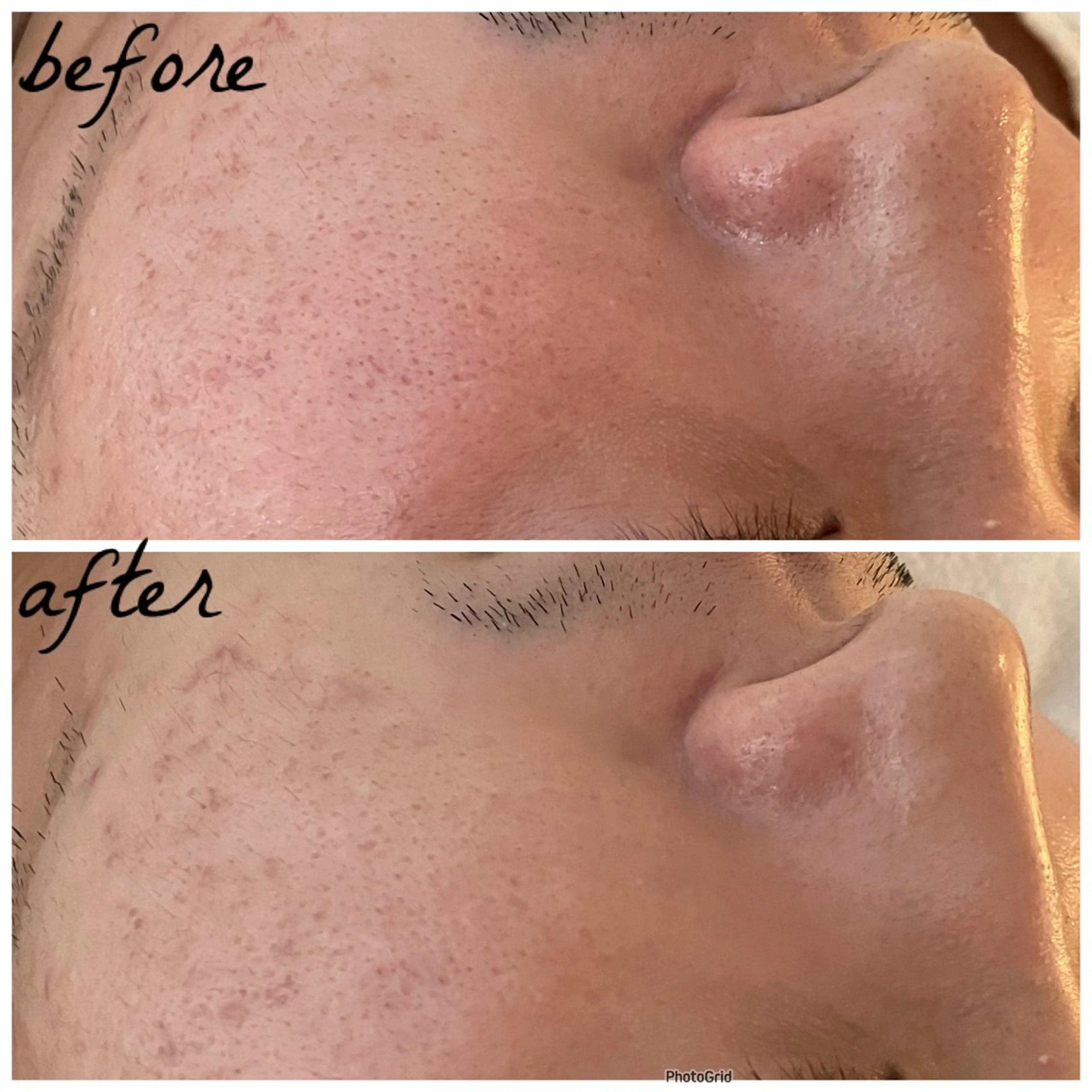 メンズ エステ メナード岐阜茜部 杉浦のエステ・リラクイメージ