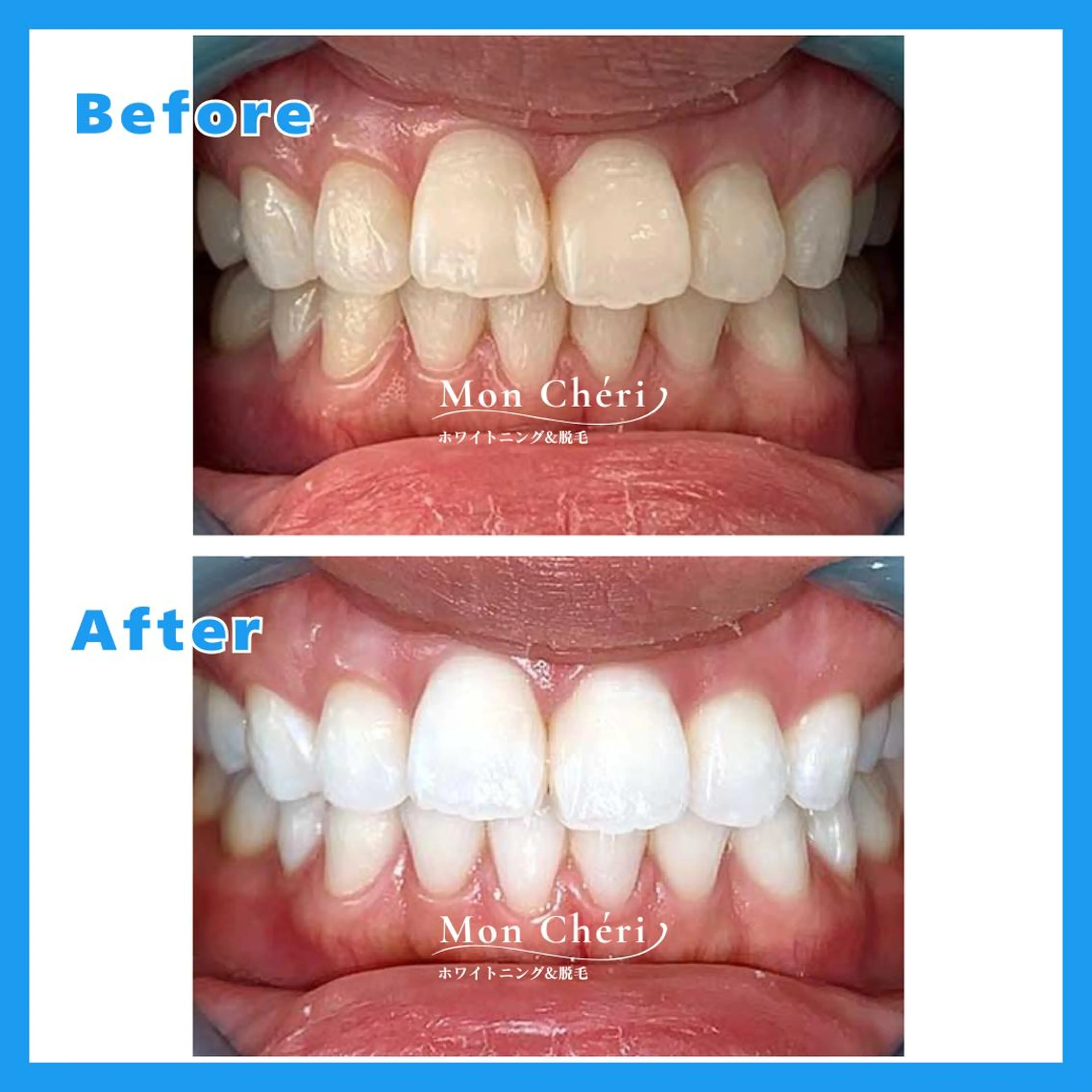 エステ Mon Cheri 広島店のエステ・リラクイメージ