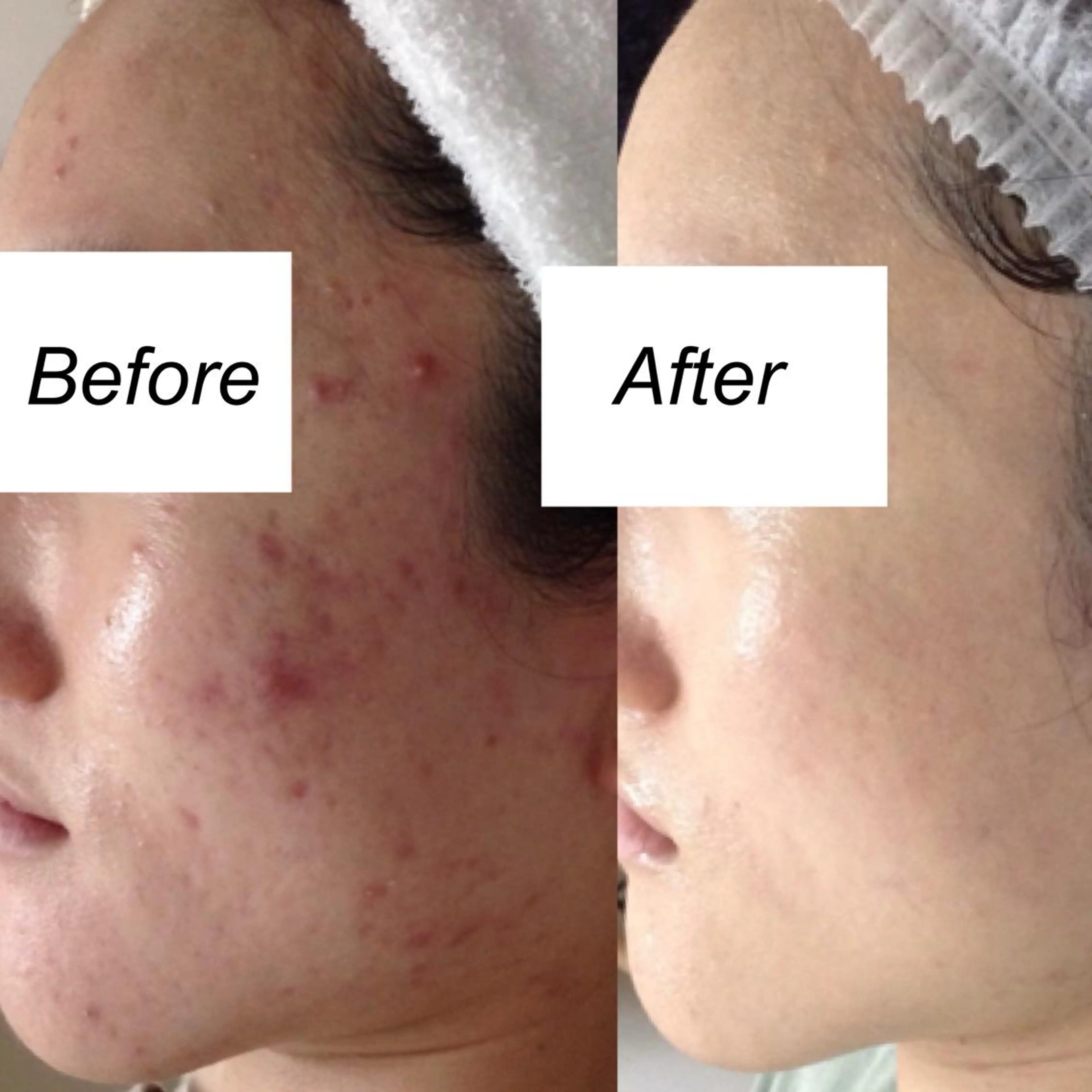 ショート カラー パーマ ヘアアレンジ キッズ ネイル マツエク・マツパ エステ リラク 都度払い肌質改善 &脱毛Blancheのエステ・リラクイメージ