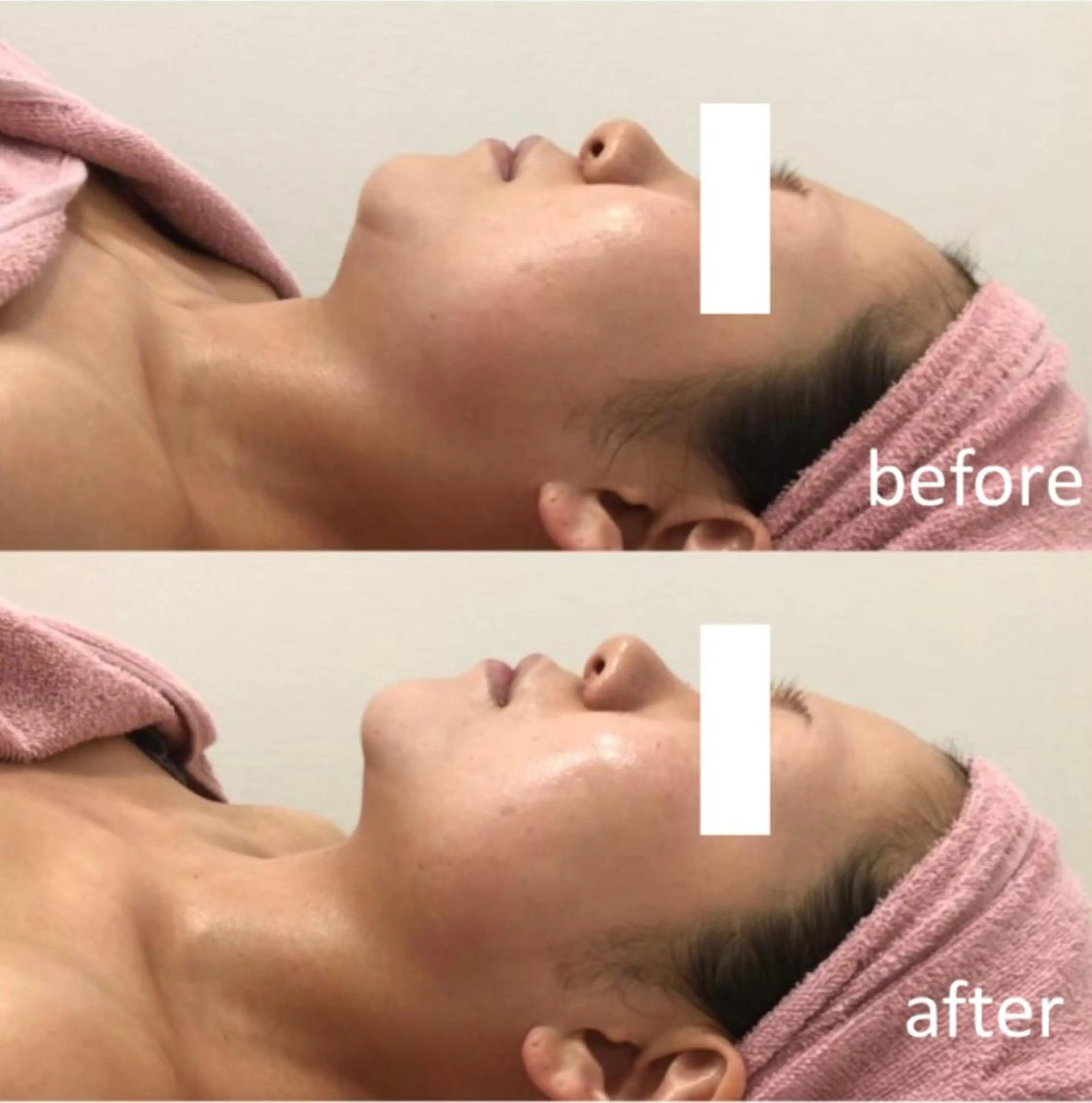 エステ beautysalon SAKUセンター南所属・ビューティーサロン SAKU センター南のエステ・リラクイメージ