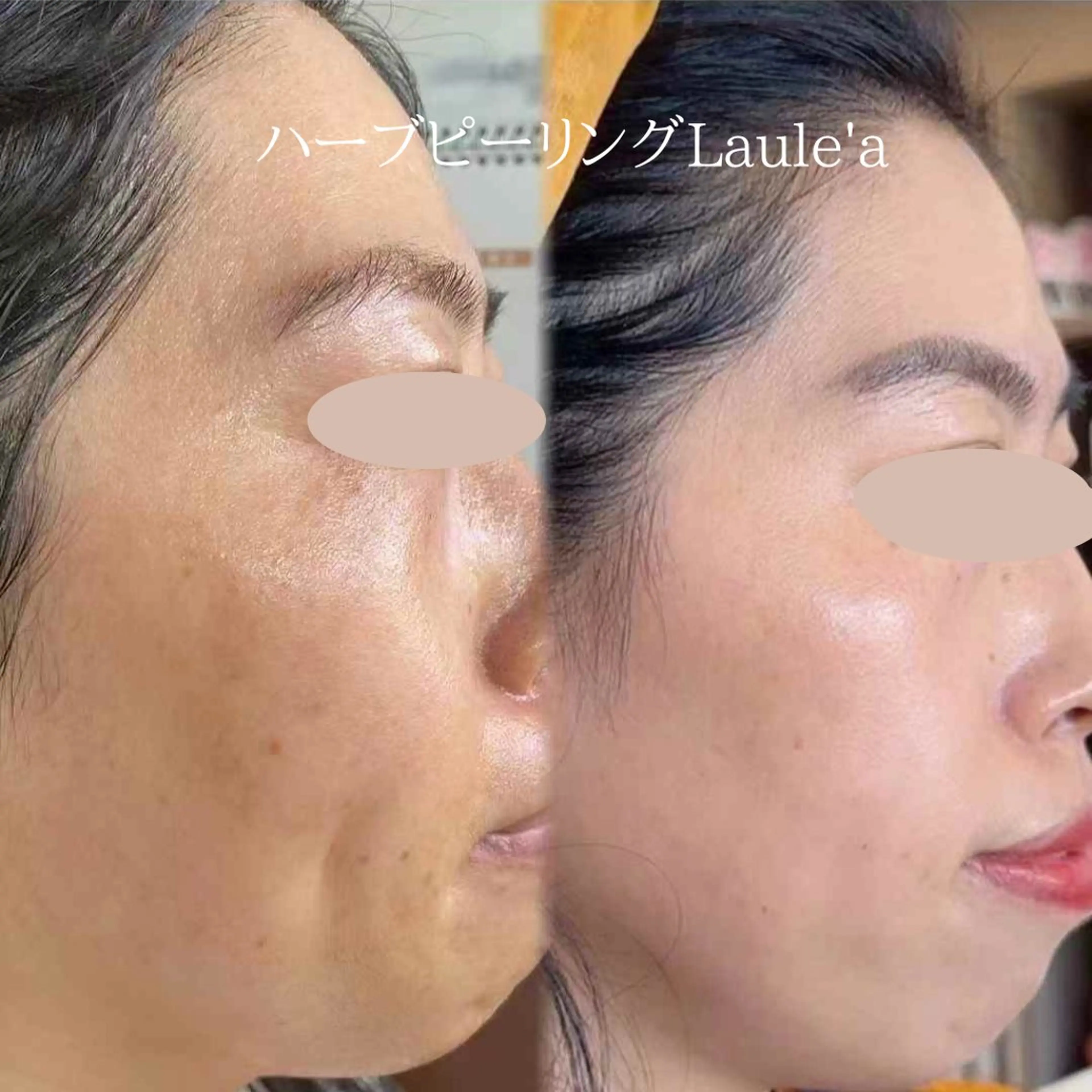 痩身/腸もみ/ ヘッドスパ/リンパのエステ・リラクイメージ