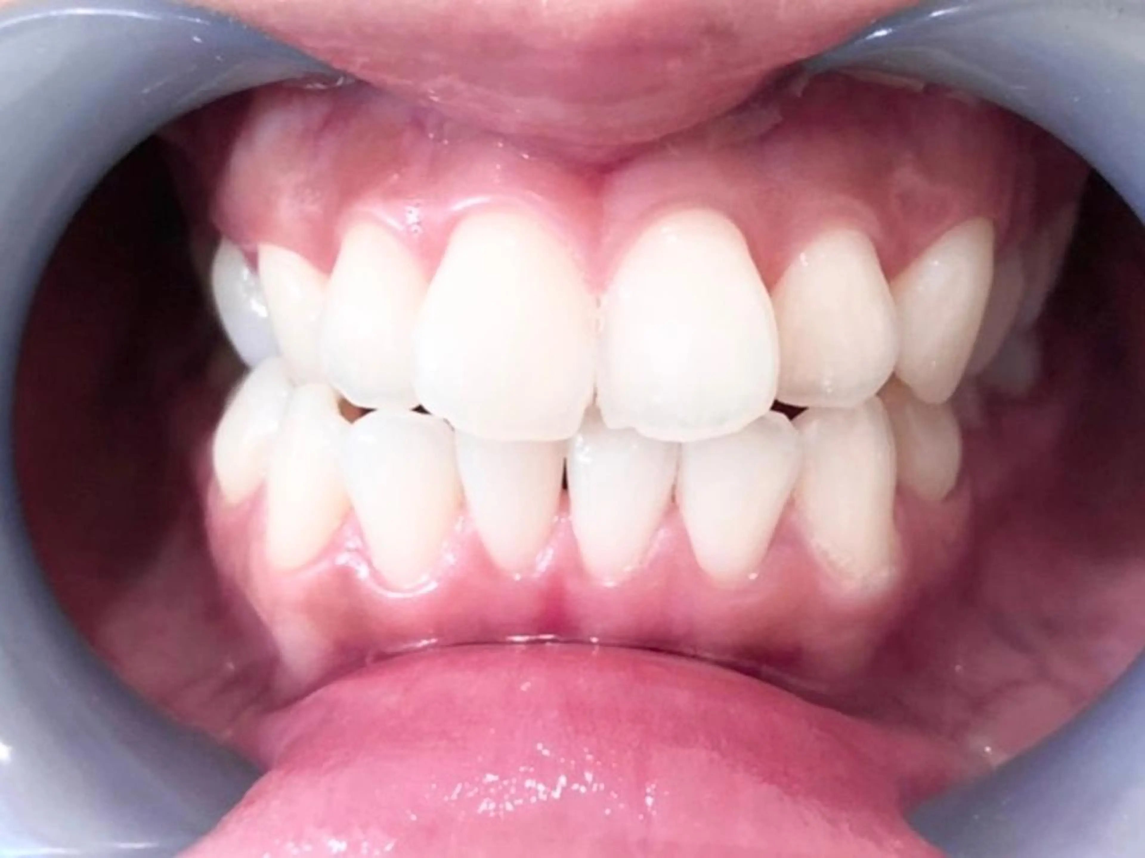 セルフホワイトニングサロン　ラヴィアン所属・ホワイトニングサロン La vie enのその他イメージ