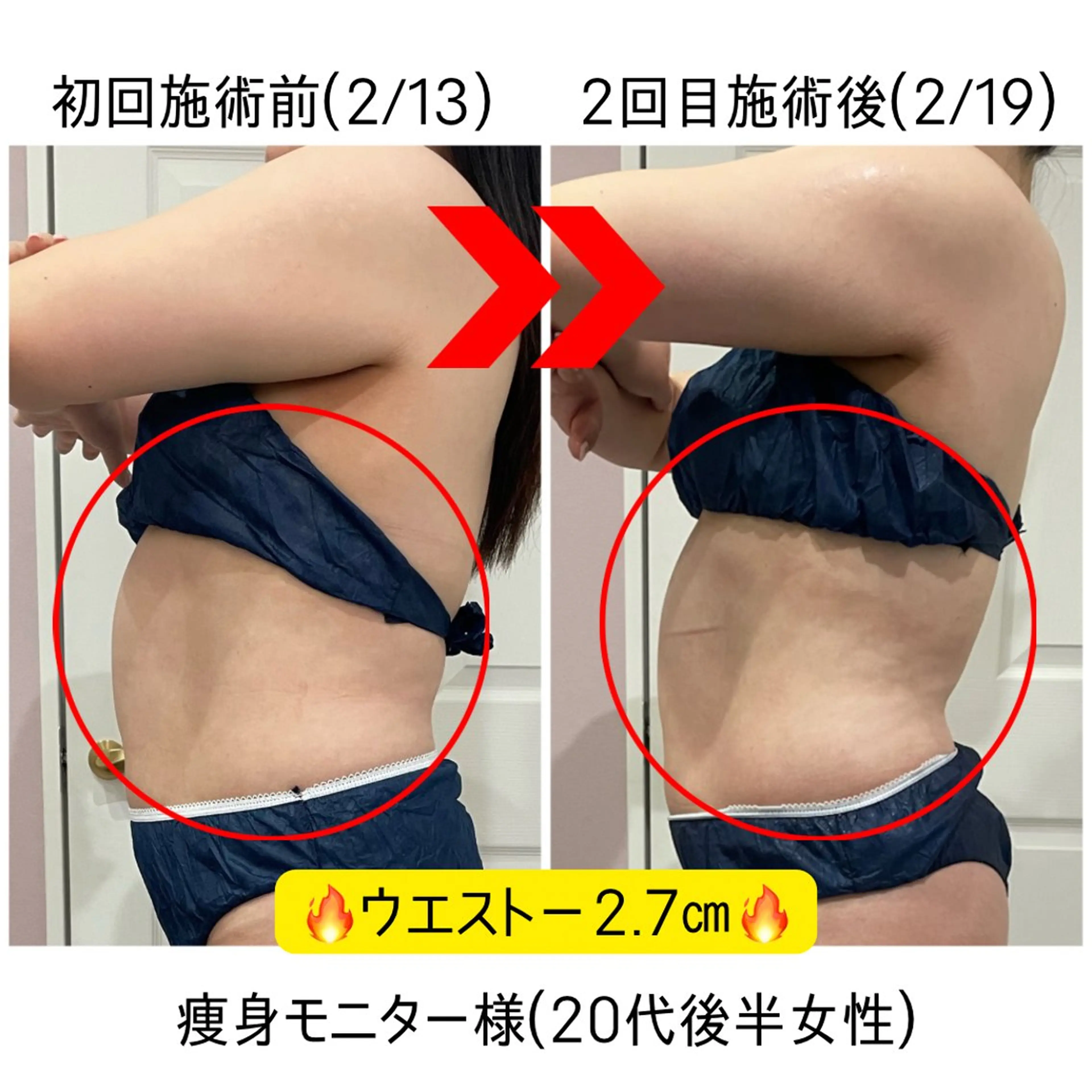 【集中して痩せたい方✨】痩身モニター募集！の写真