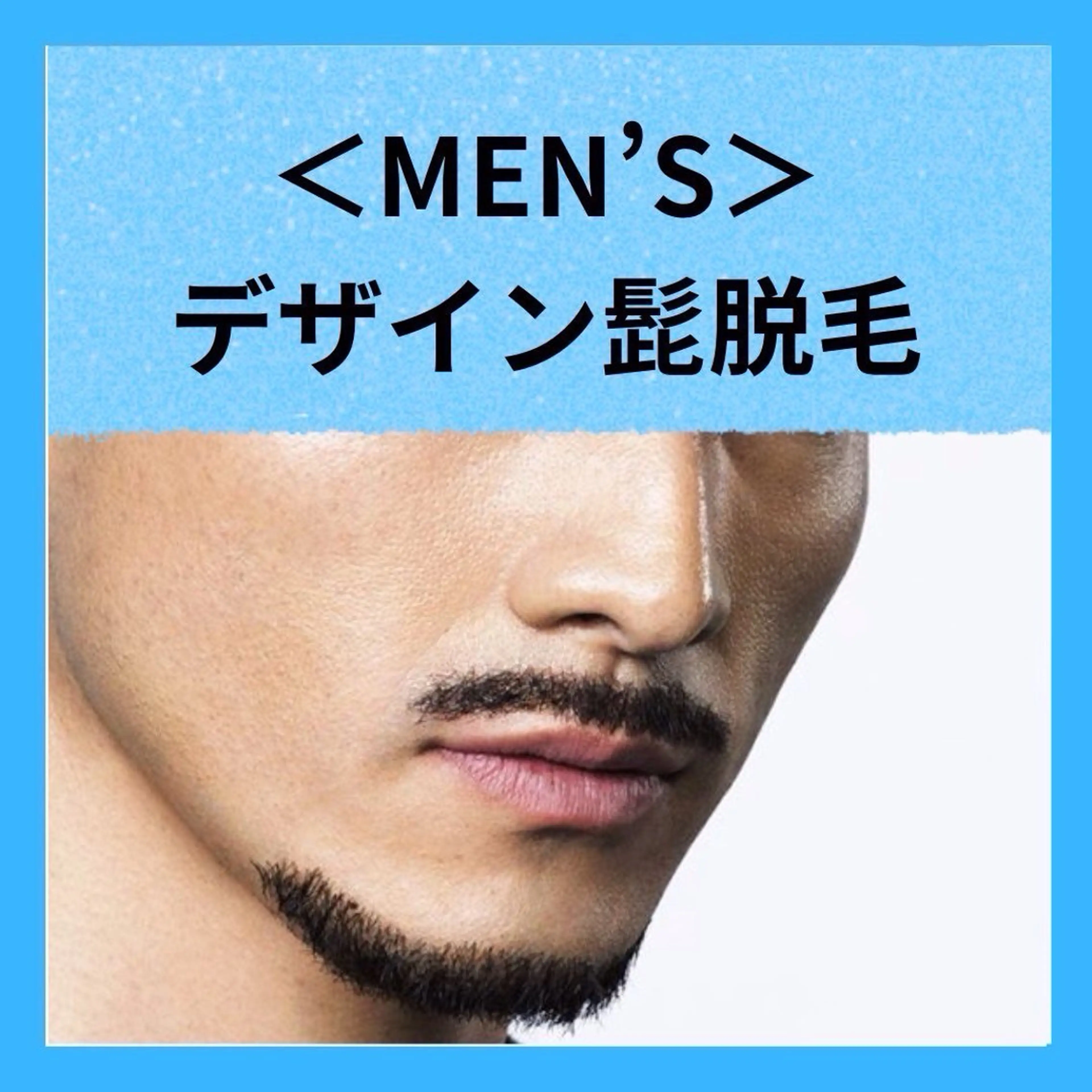 【男性脱毛】ヒゲのこだわり☆デザインヒゲ脱毛お好みのデザインに脱毛の写真