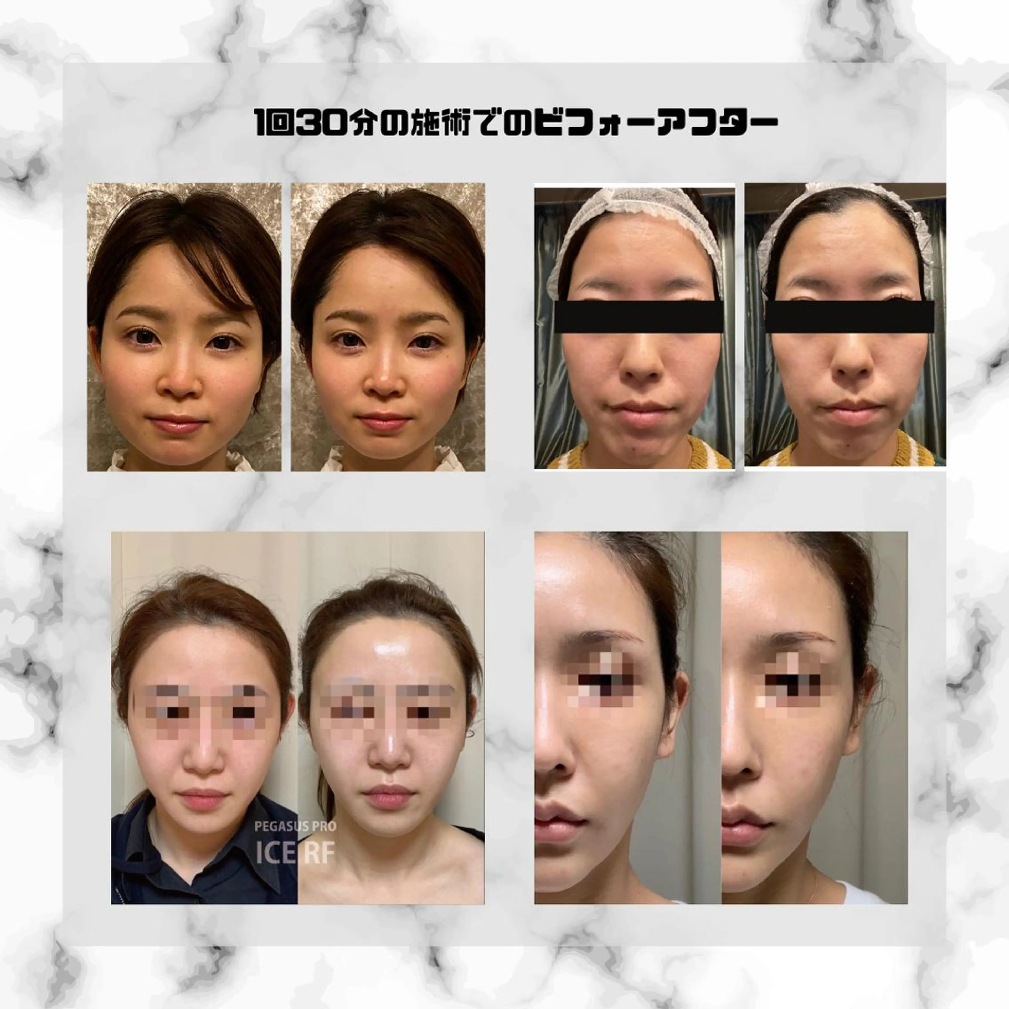 男女同額脱毛エステ salonLEPIAのエステ・リラクイメージ