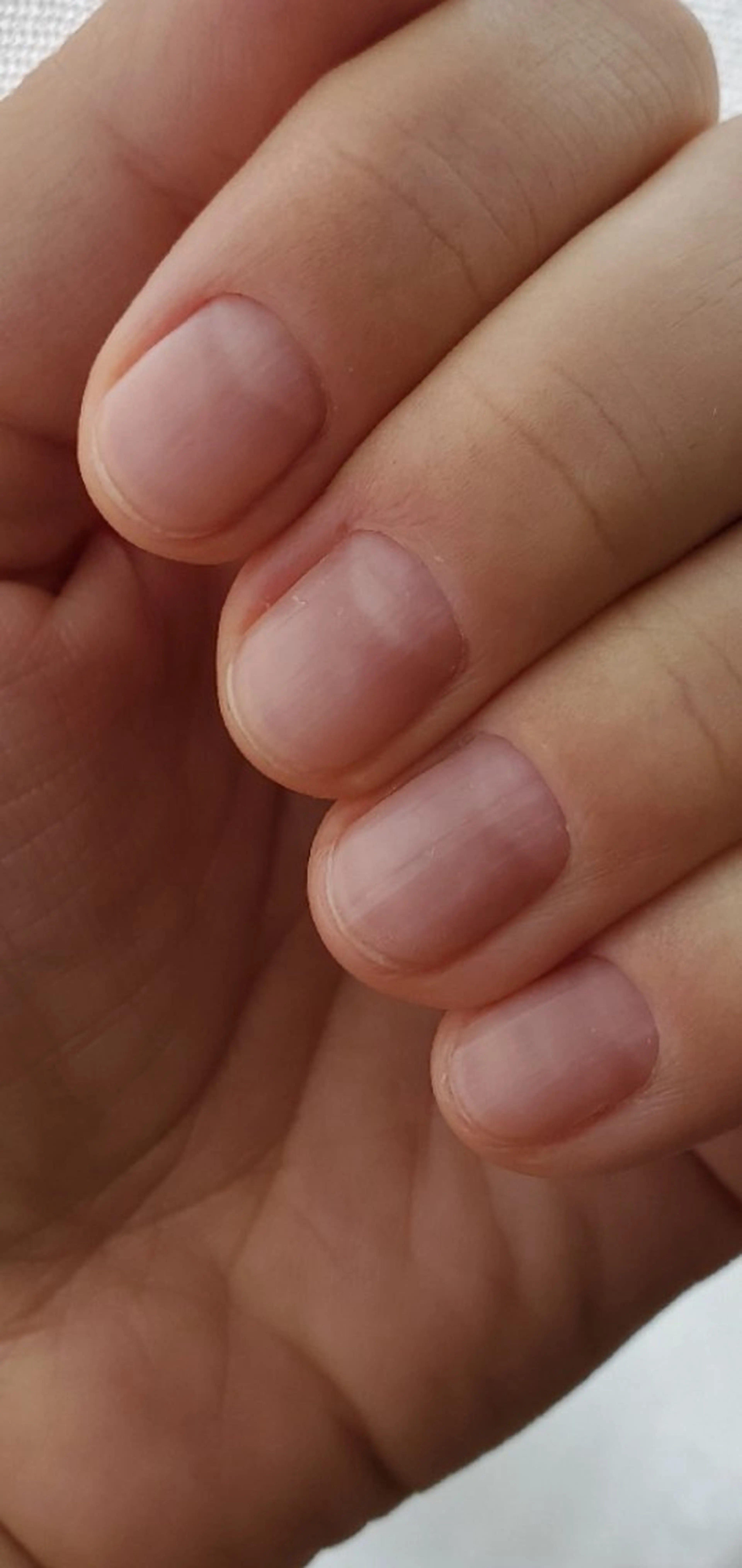 ♀️女性 💅ケア ネイルコース[ ジェル オフのみ+20分]の写真