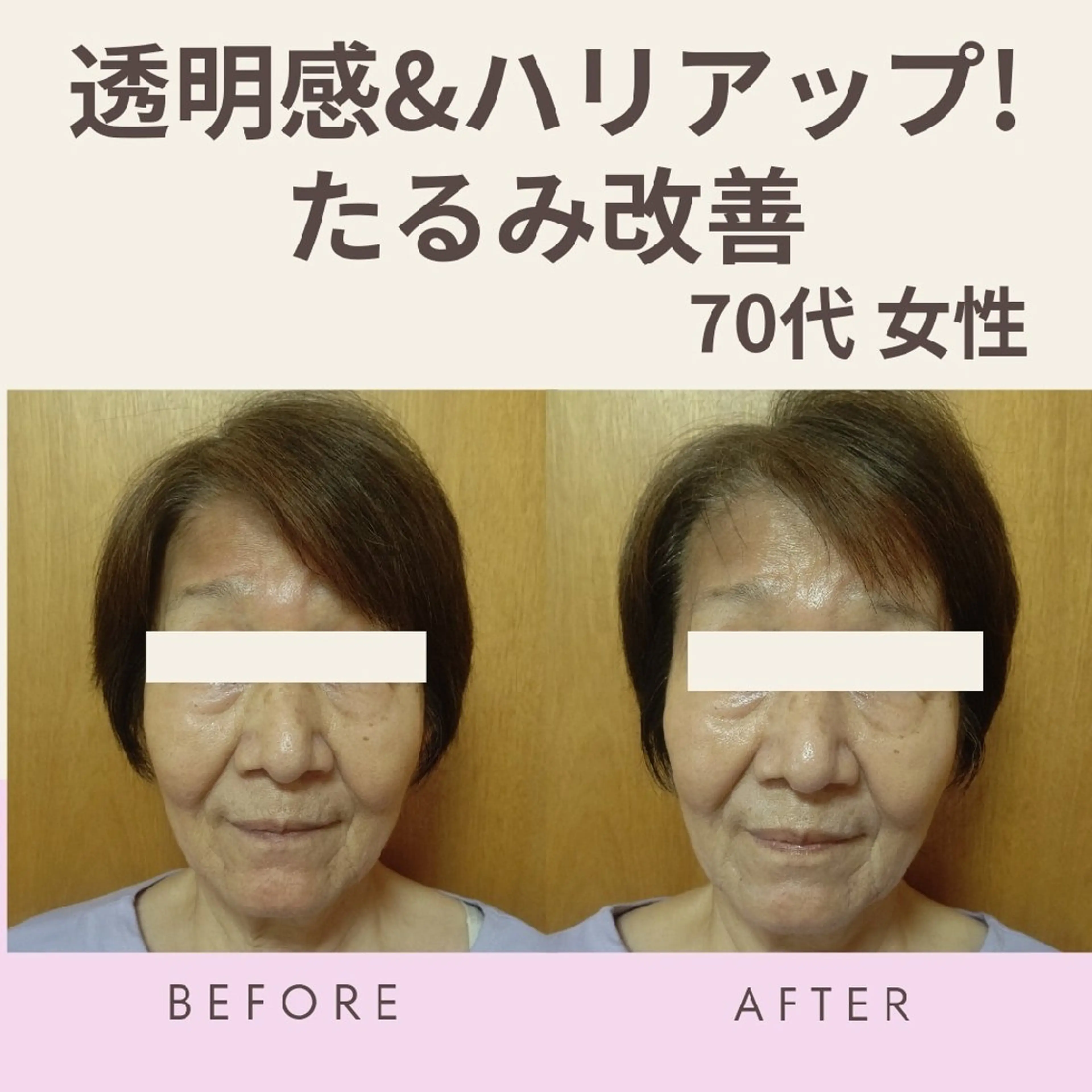 エステ 畑 彩愛のエステ・リラクイメージ