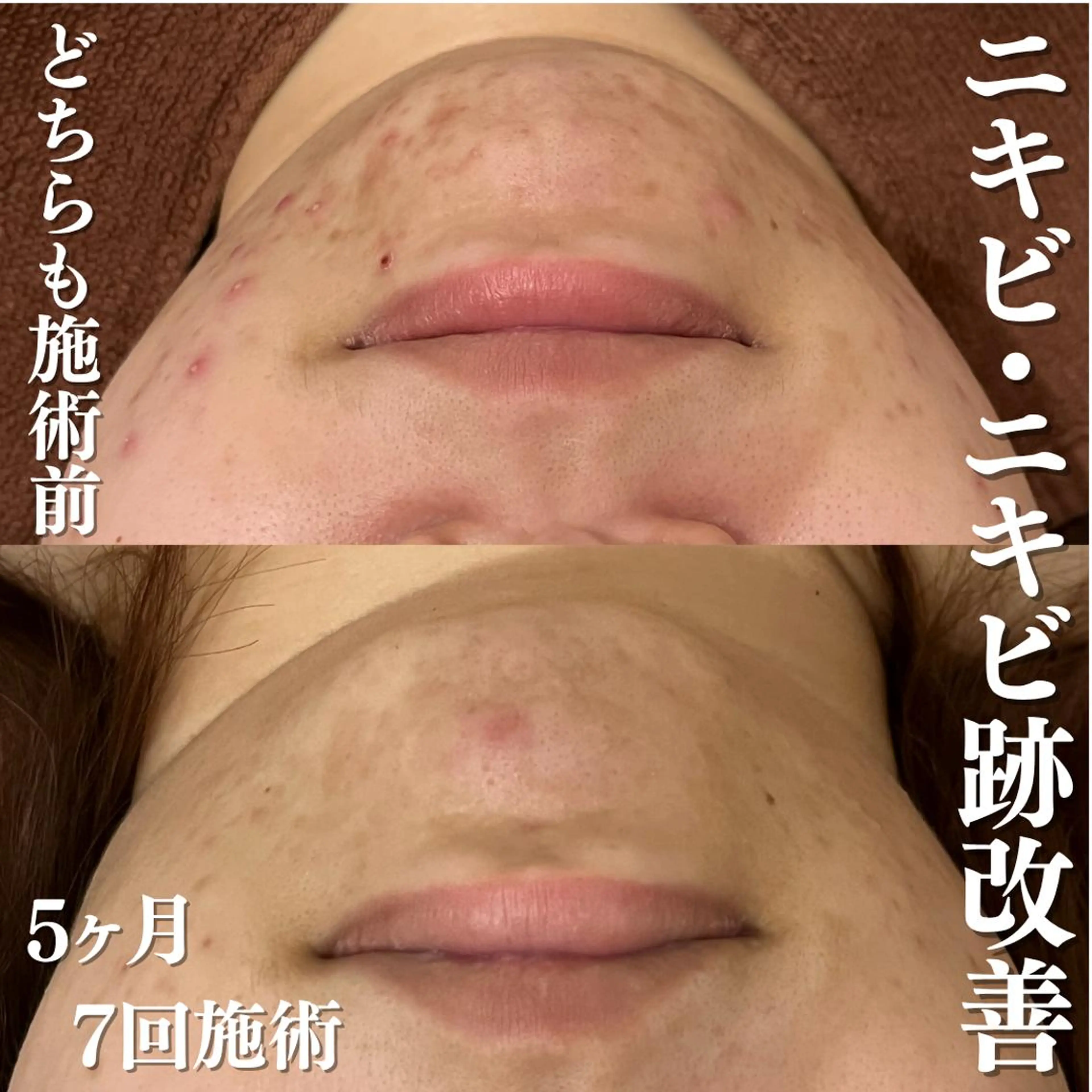 来春までに脱・肌荒れ できるサロン✨のエステ・リラクイメージ