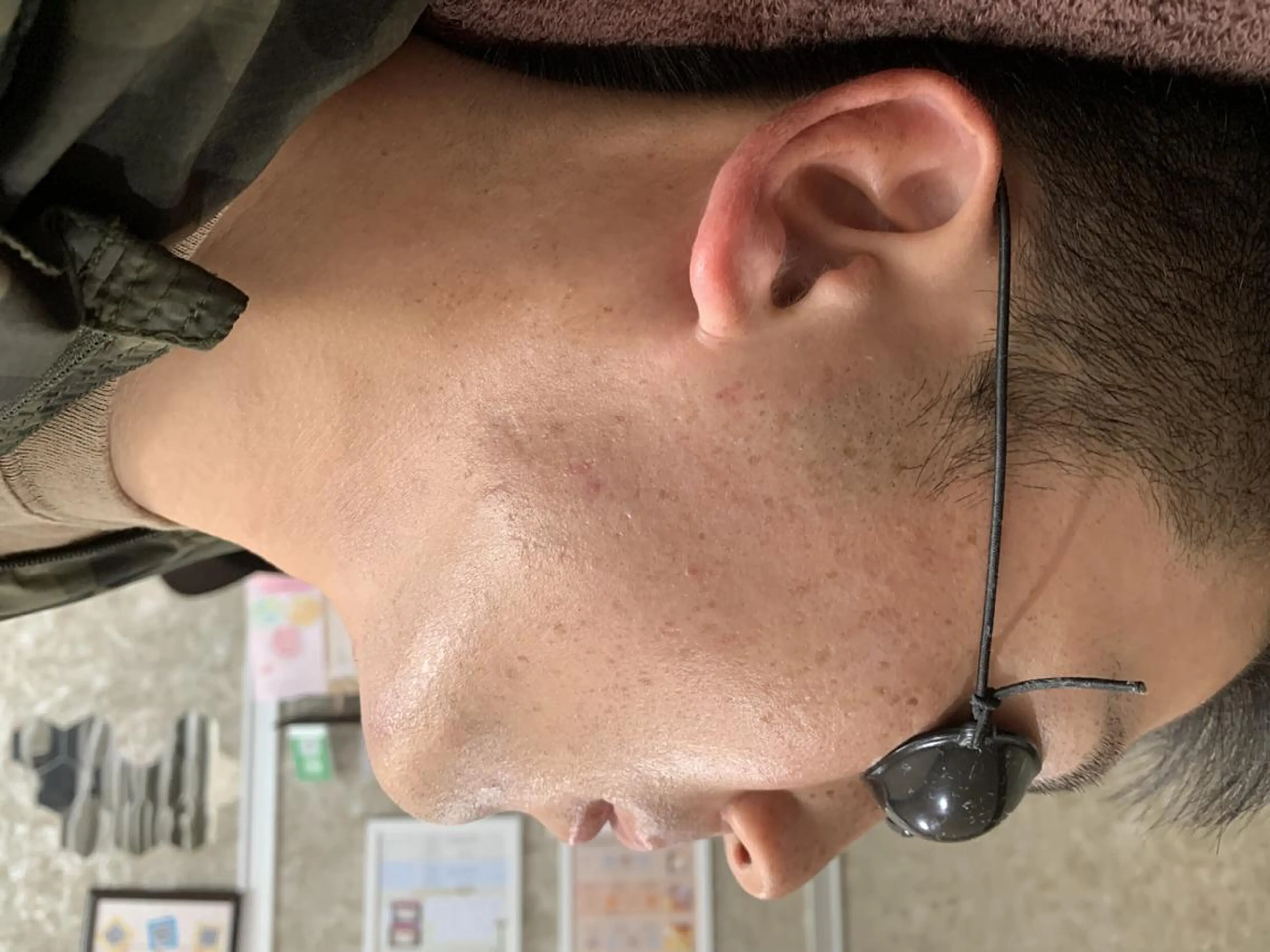 メンズ 20代から始める脱毛 salonLEPIAのエステ・リラクイメージ