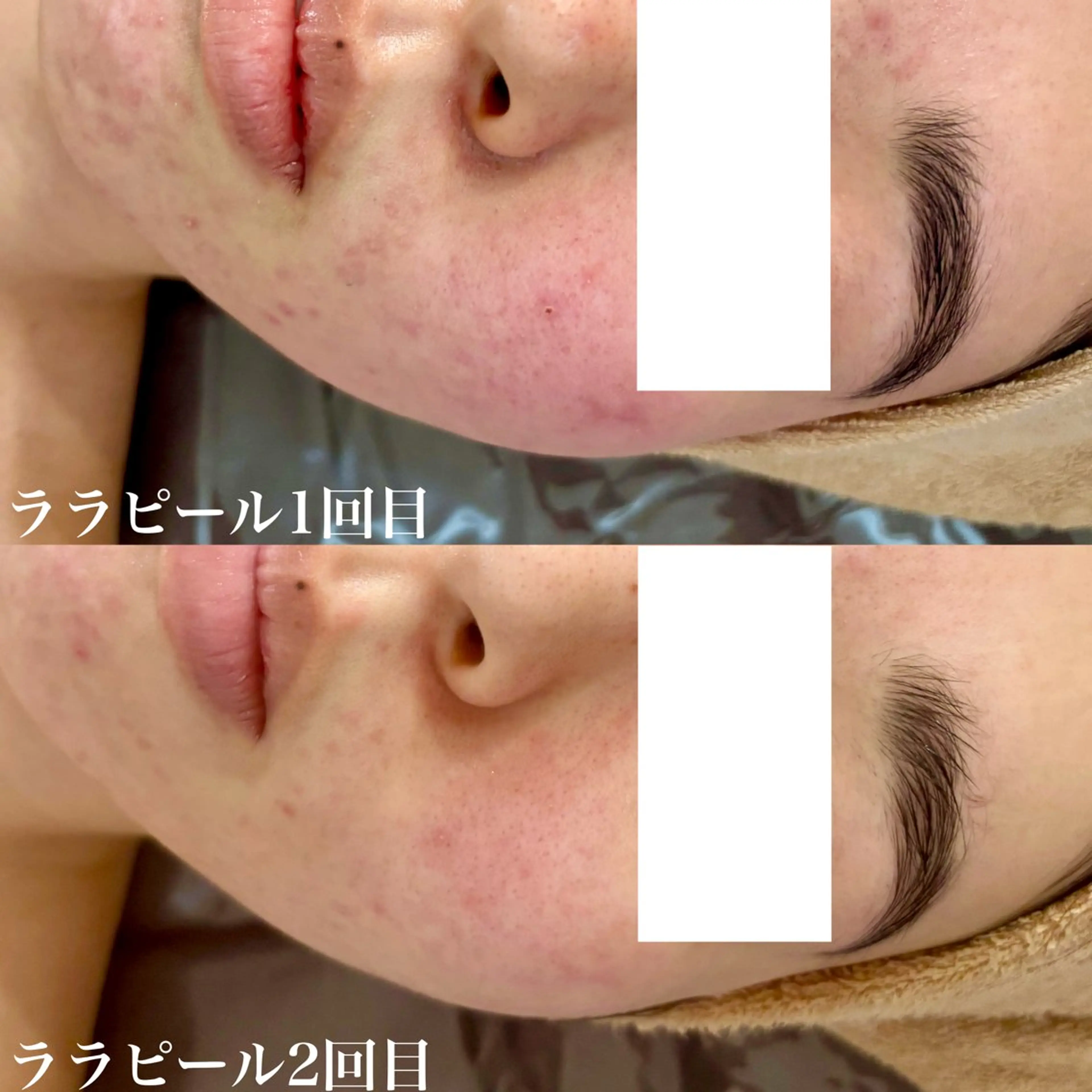 その他 WHITE AQUA 北千住店のエステ・リラクイメージ