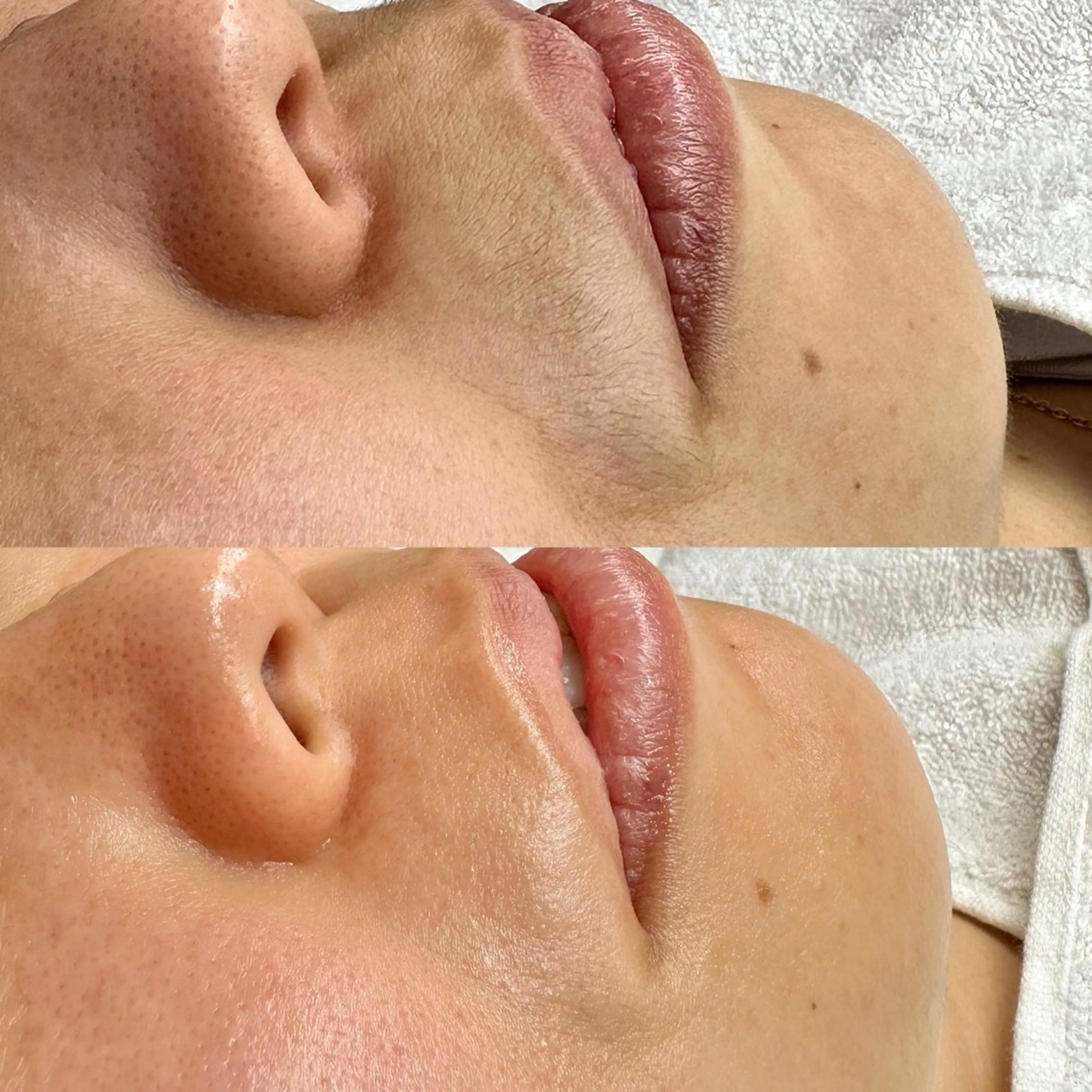 エステ マツヤニワックス専門 堂山町 ルミエールのエステ・リラクイメージ