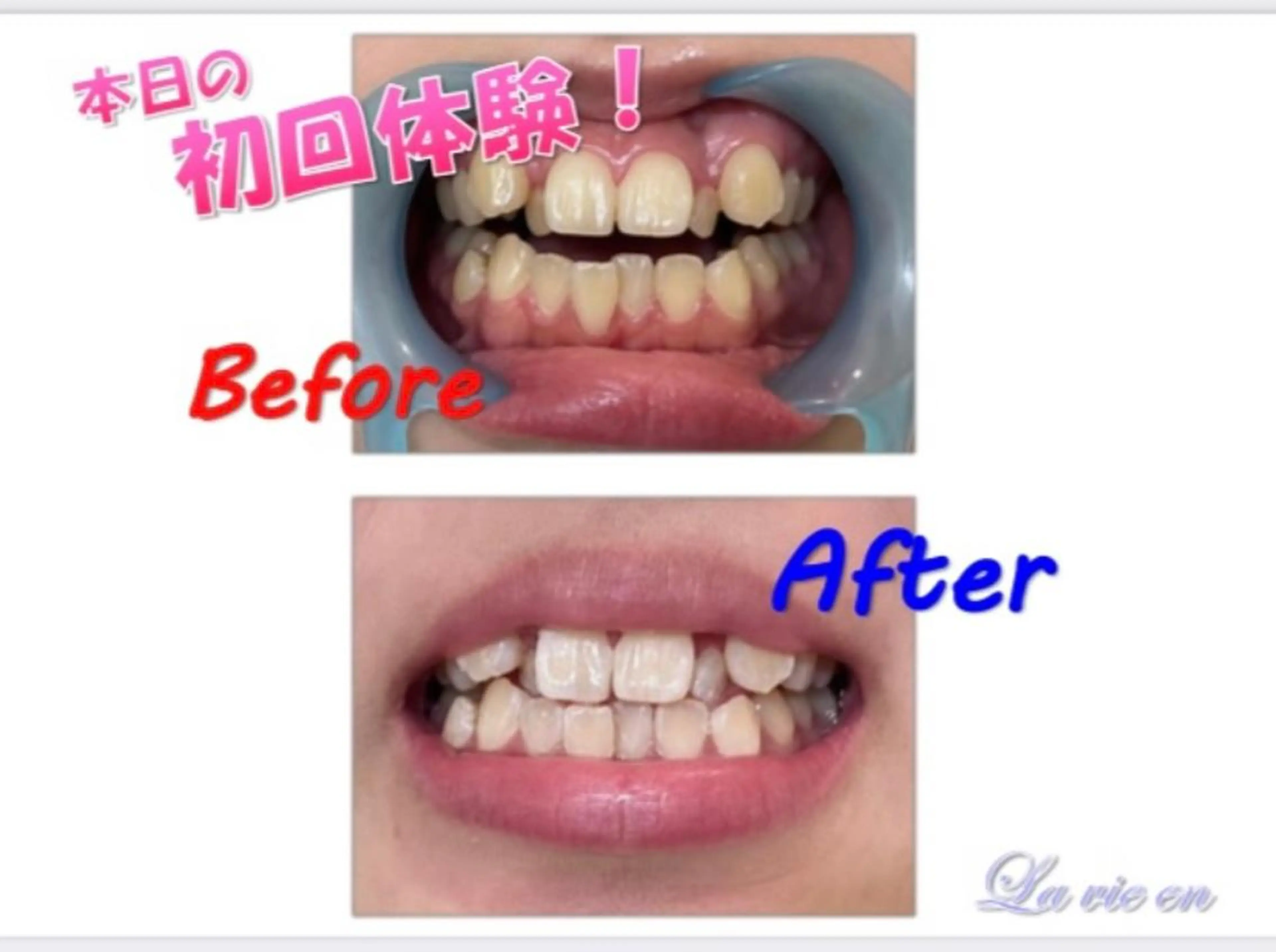 その他 セルフホワイトニングサロン　ラヴィアン所属・ホワイトニングサロン La vie enのその他イメージ