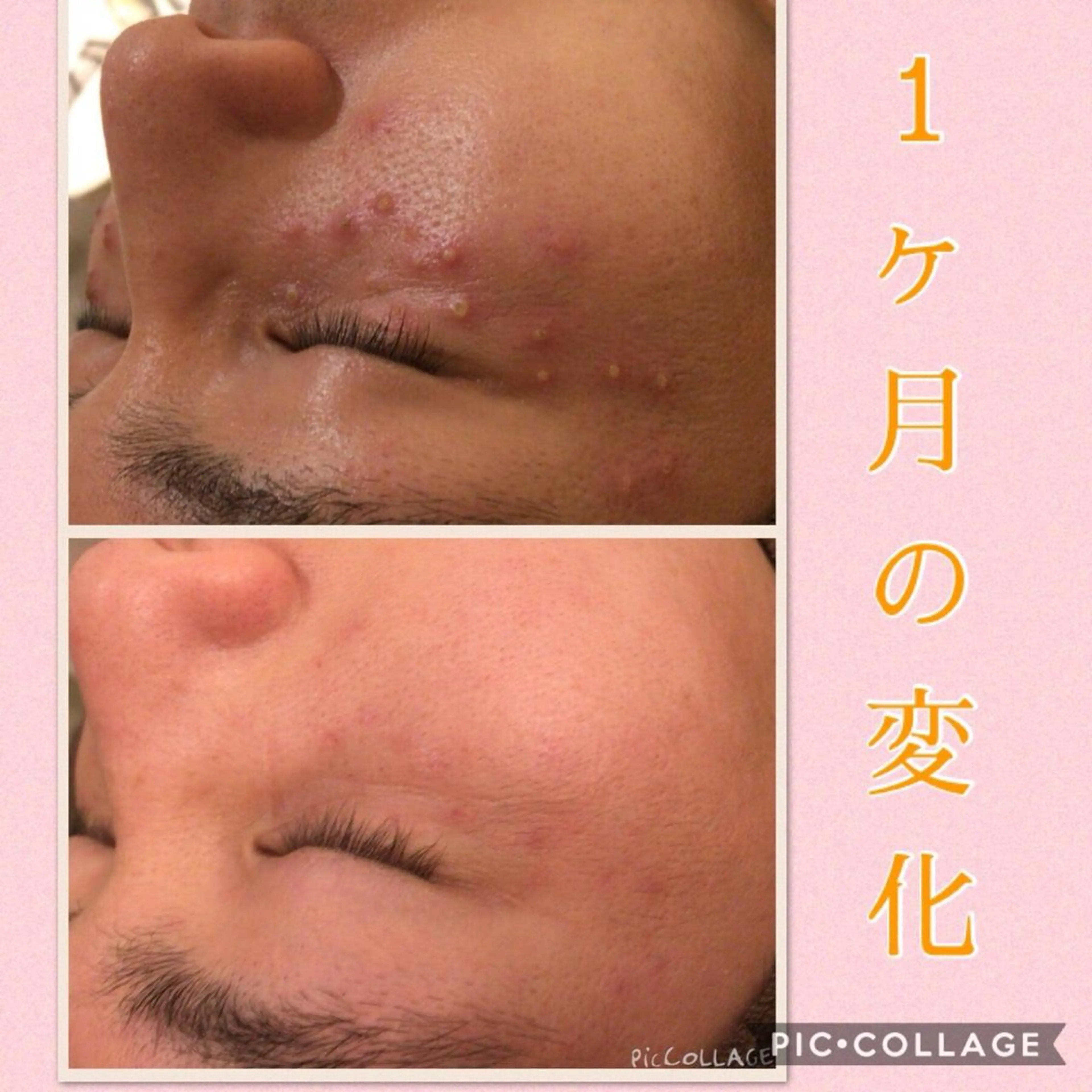 ミディアム カラー パーマ ヘアアレンジ メンズ キッズ ネイル マツエク・マツパ アクール　齋藤 ♡肌トラブル卒業のエステ・リラクイメージ