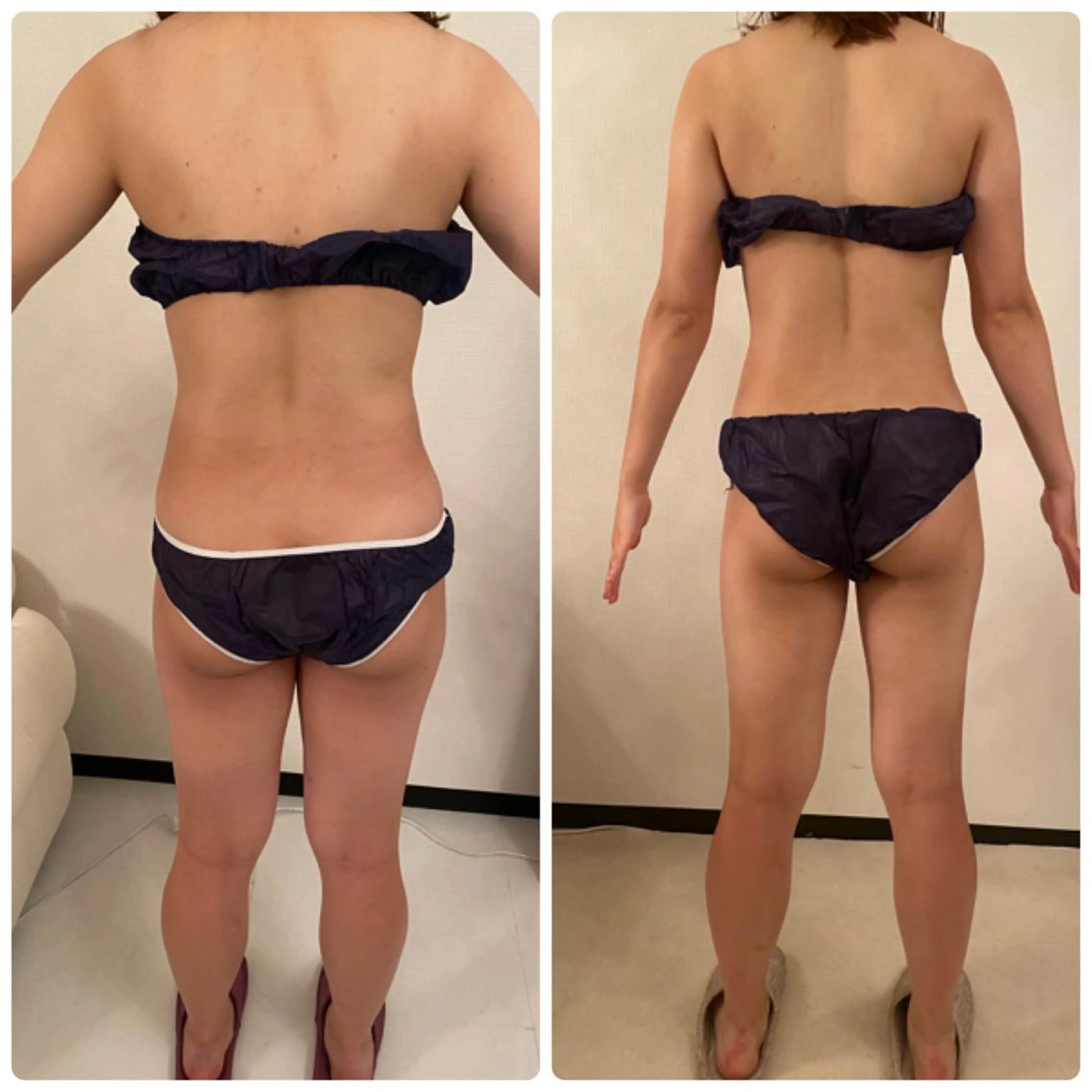 FLEUR大阪・整体 ・ハイフ・痩身・小顔のエステ・リラクイメージ